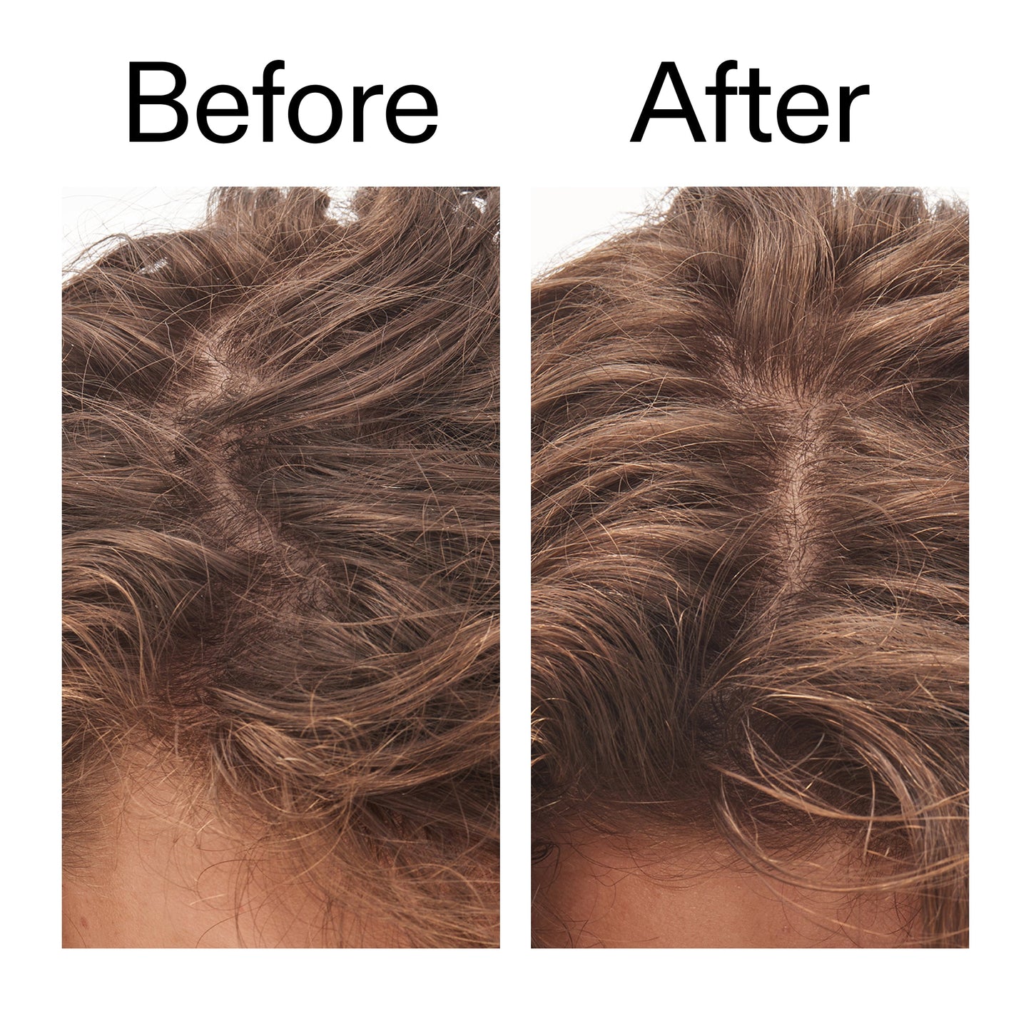 glycolic-acid-exfoliating-scalp-scrub-x8 Glycolic_Acid_Exfoliating_Scalp_Scrub_Before_After_2000x2000_b8561c87-05a1-4caa-80f7-1b6b33d750f7.jpg