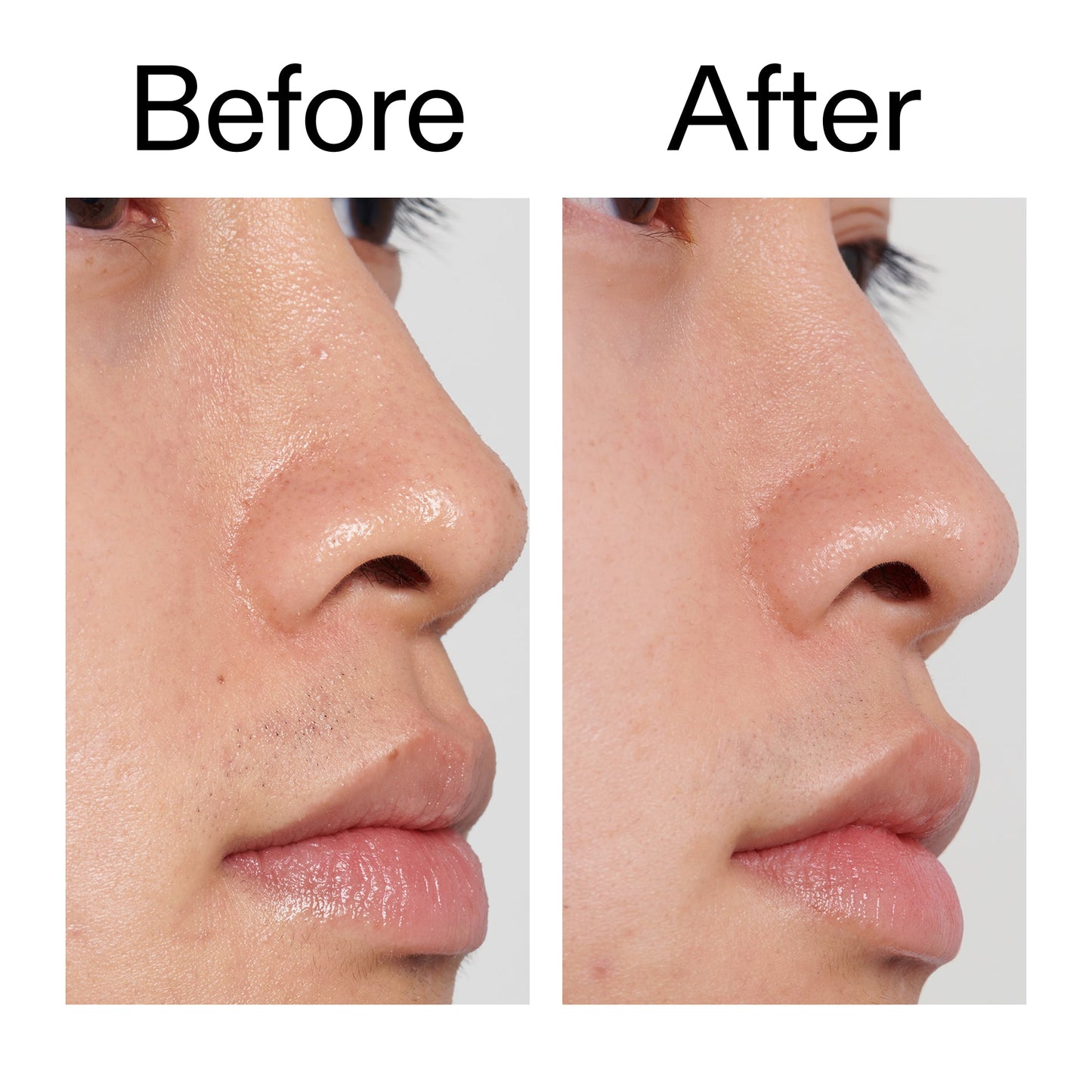 pha-toner-d5 PHA_Toner_Before_After_2000x2000_e3c10172-0150-4342-8b95-57417eaff50d.jpg