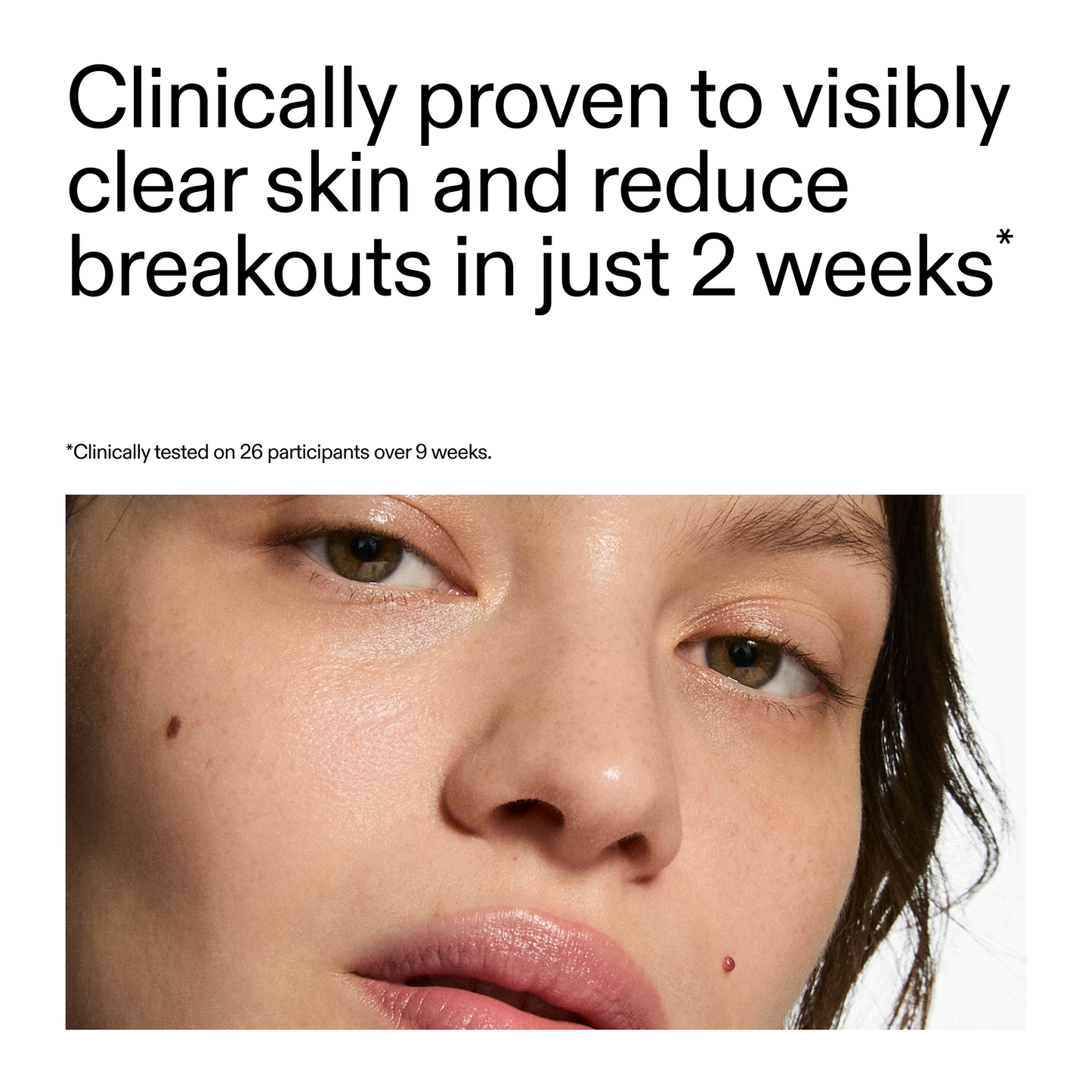 360-acne-clearing-duo-c3 360_Serum_Key_Claim.png