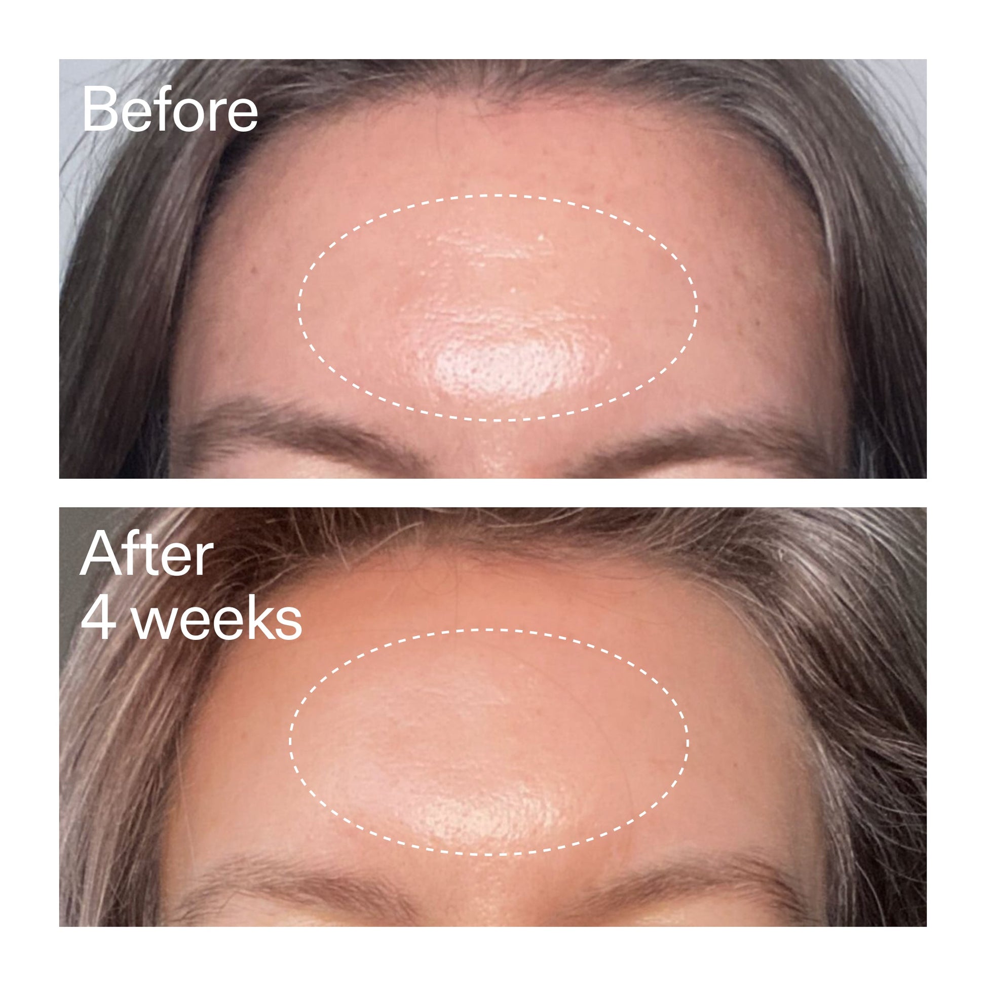 advanced-0-2-retinal-serum-duo-x0 AdvancedRetinal_BeforeAfter1_2000x2000_4e9c798a-f30e-45b8-a34a-7c4740f2f2cb.jpg
