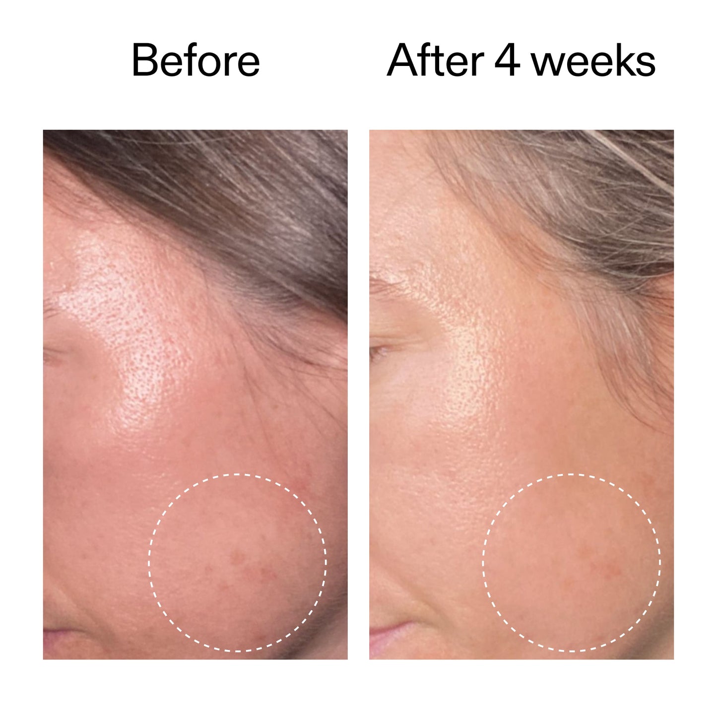 advanced-0-2-retinal-serum-duo-x0 AdvancedRetinal_BeforeAfter2__2000x2000_8ef75542-2316-4814-81ee-0f66a85912bc.jpg