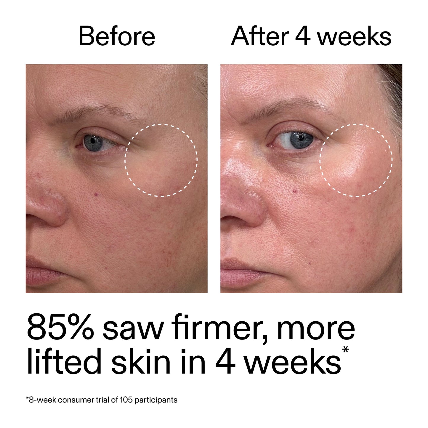 advanced-0-2-retinal-serum-duo-x0 AdvancedRetinal_BeforeAfter_Claim1_2000x2000_3a315aa8-f408-4b33-bbeb-0d9209f98404.jpg