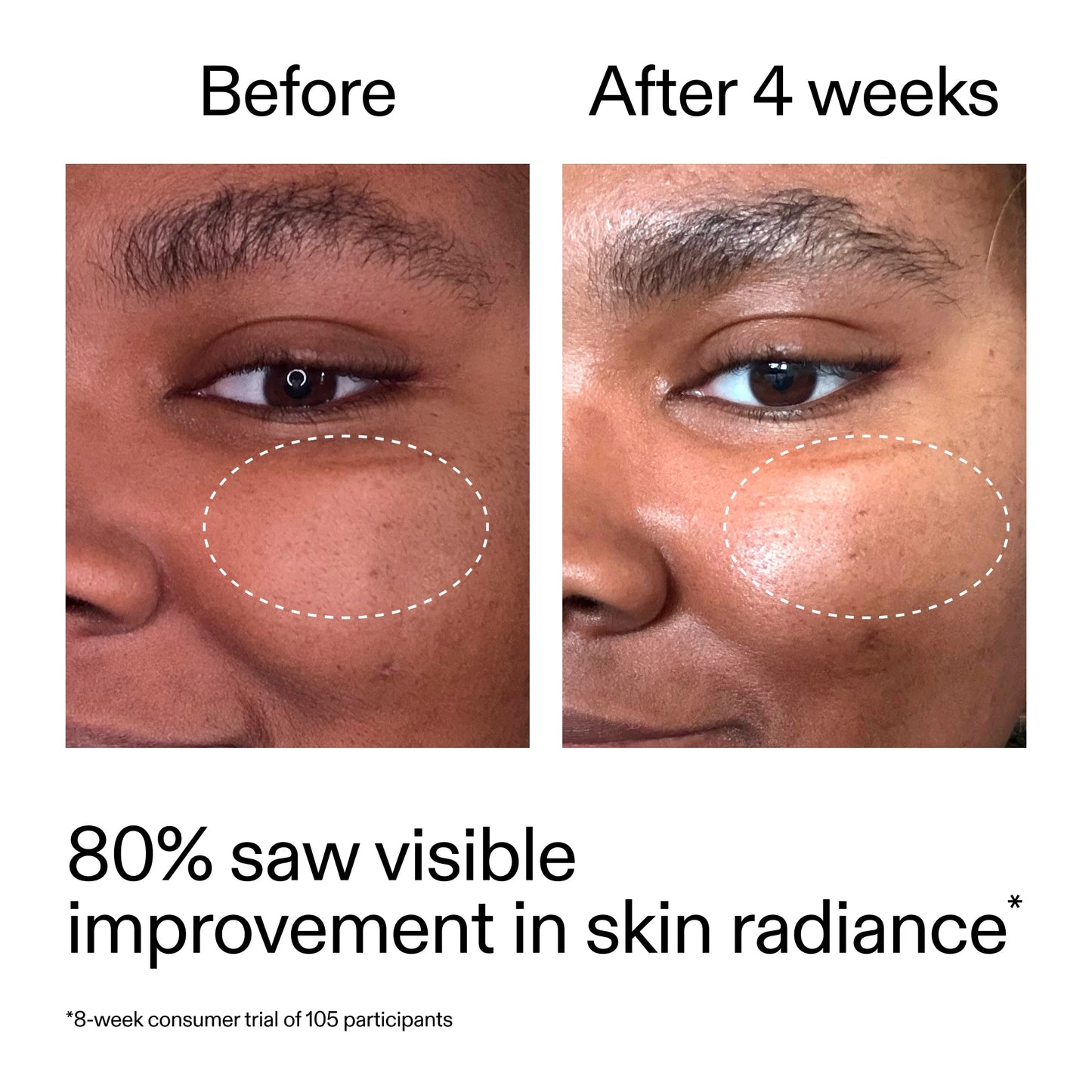 advanced-0-2-retinal-serum-duo-x0 AdvancedRetinal_BeforeAfter_Claim2_2000x2000_681b621d-8d44-4d44-9a40-89244f9b2e53.jpg