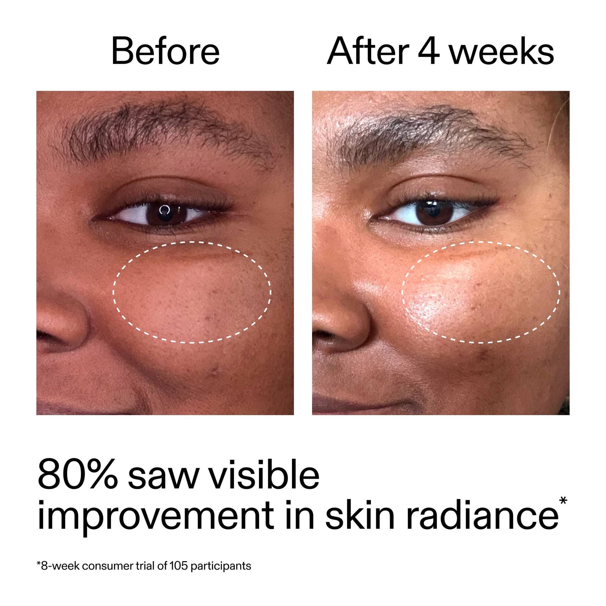 advanced-0-2-retinal-serum-duo-x0 AdvancedRetinal_BeforeAfter_Claim2_2000x2000_681b621d-8d44-4d44-9a40-89244f9b2e53.jpg