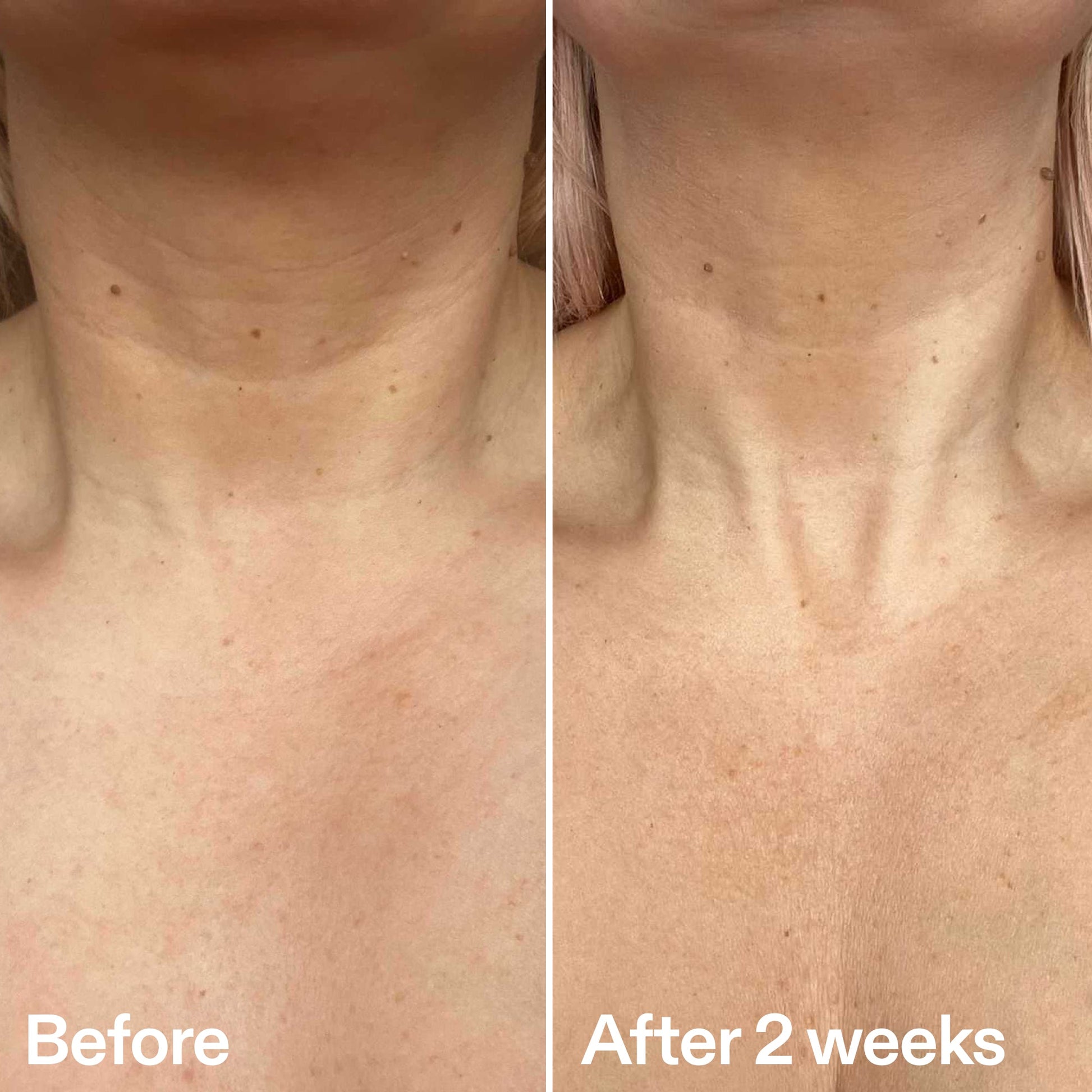 bio-active-neck-lift-stick-h6 B_A_2.jpg