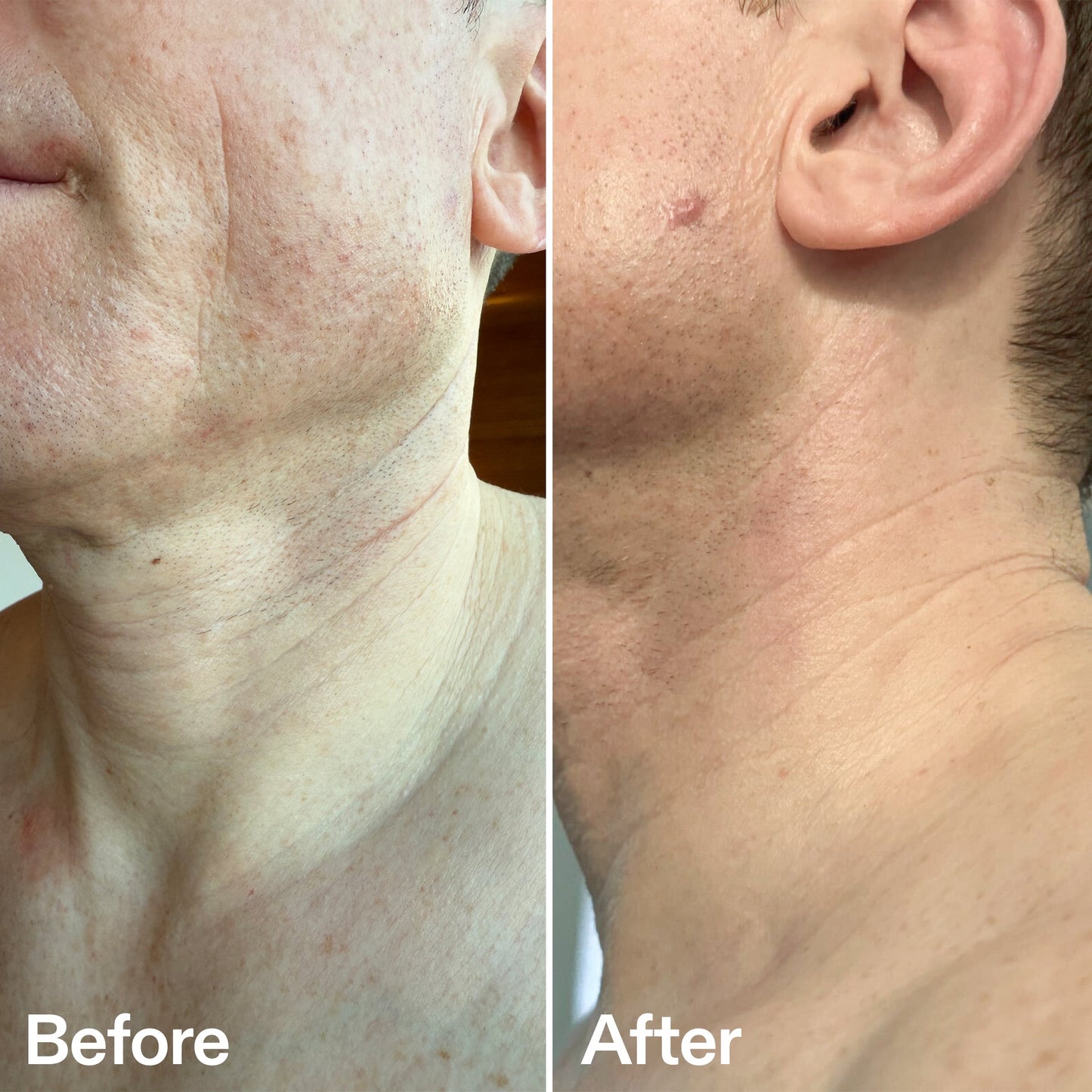bio-active-neck-lift-stick-h6 B_A_afa2743e-b8e2-4504-92f4-e281cb6cf759.jpg