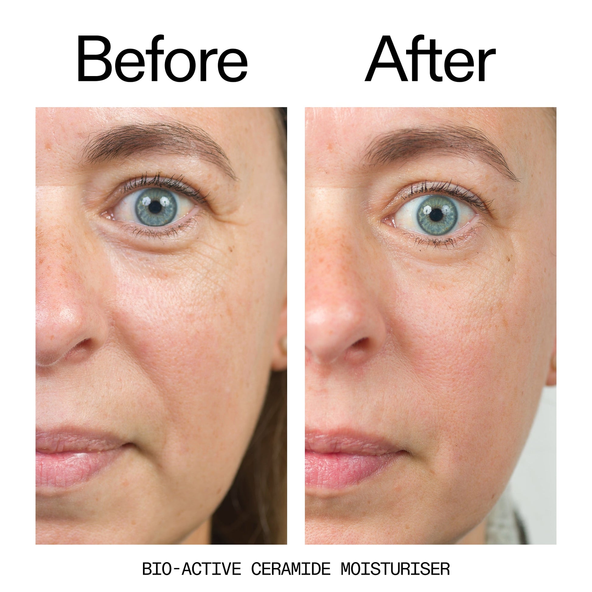 barrier-boosting-trio-r8 Bio-Active_Before_After_2000x2000_600947b4-e8c5-425a-9155-fc15bc83aa12.jpg