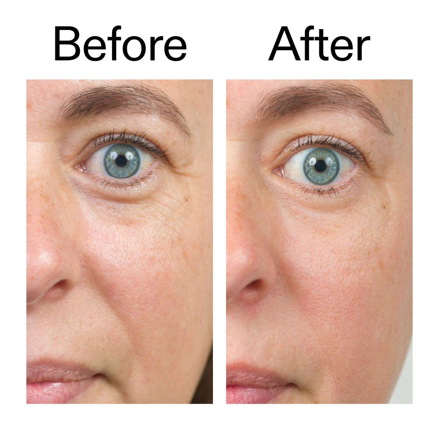 bio-active-ceramide-moisturizer-q6 Bio-Active_Before_After_2000x2000_566e5a9e-135e-417a-8242-b44e5fa35463.jpg