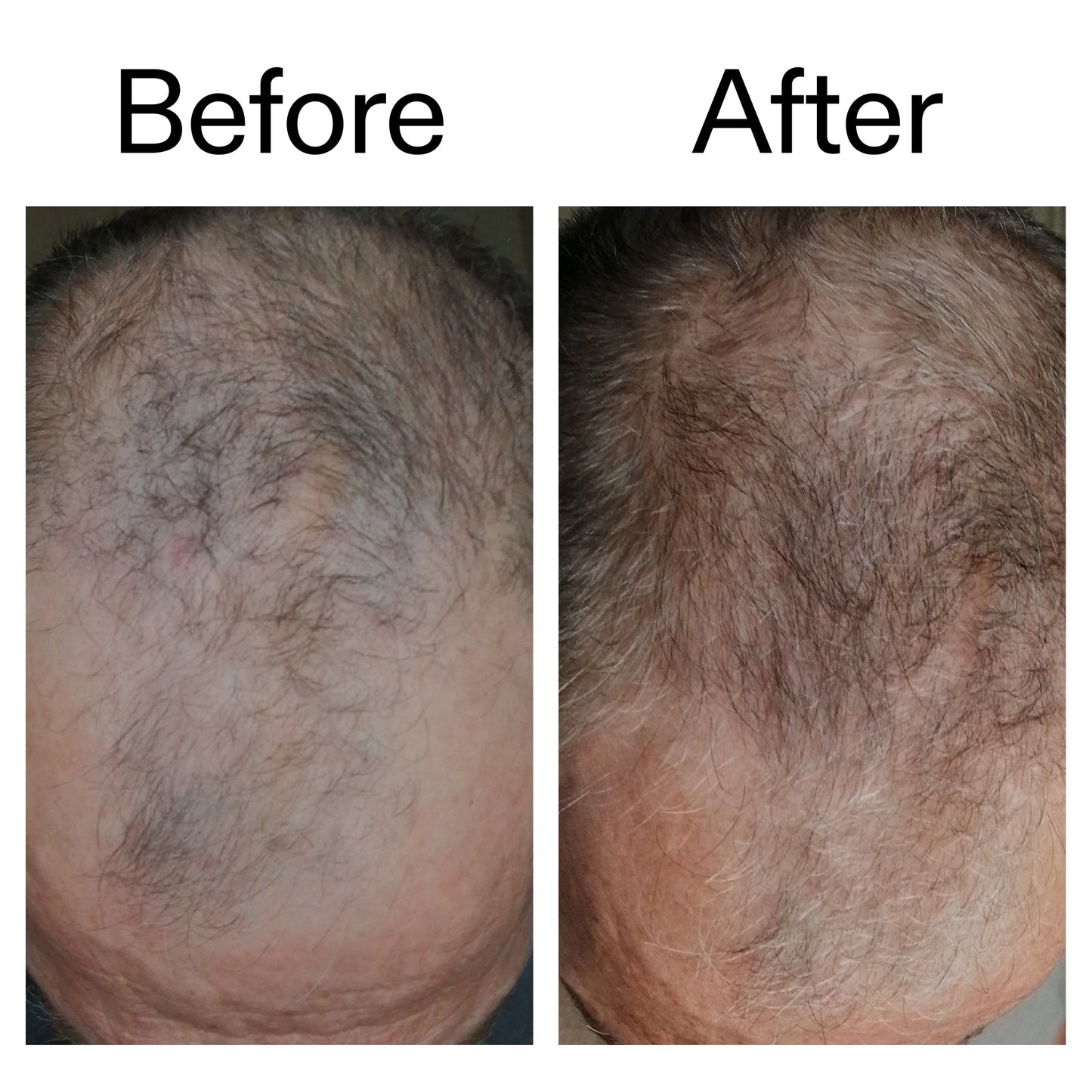 3-month-hair-growth-trio-b9 Caffeine_Scalp_Treatment_B_A_Ppage_2000_x_2000.jpg