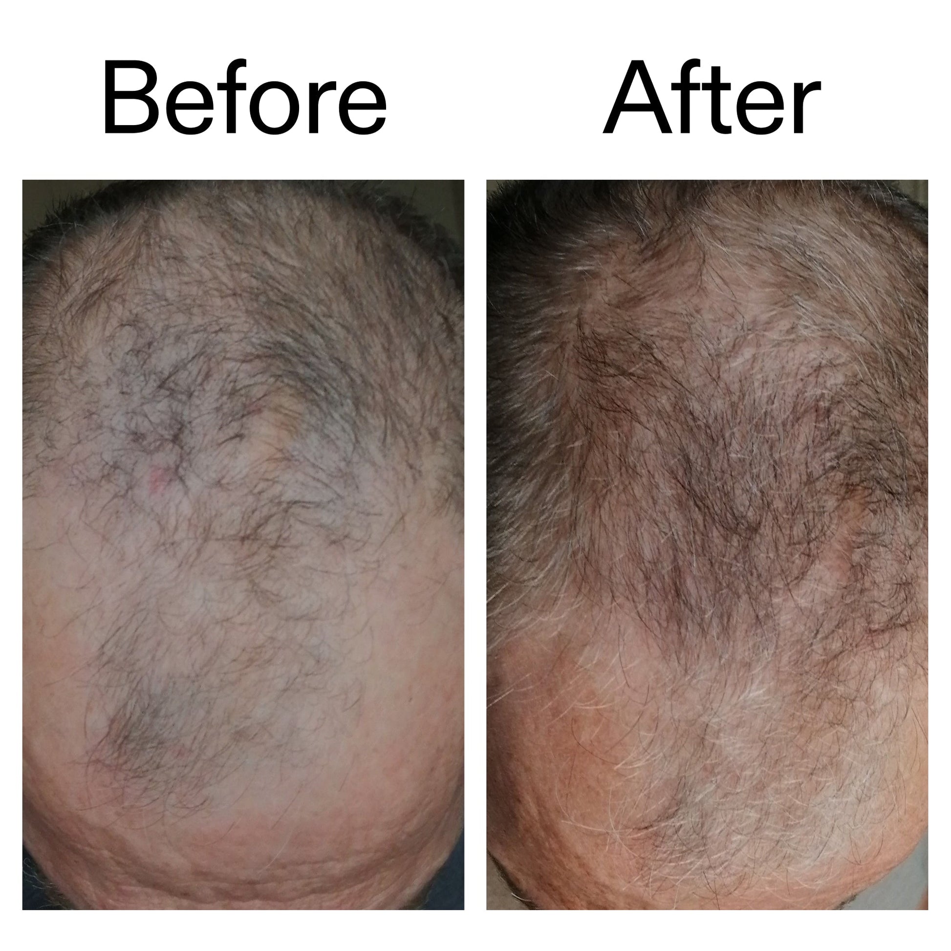 3-month-hair-growth-trio-b9 Caffeine_Scalp_Treatment_B_A_Ppage_2000_x_2000.jpg