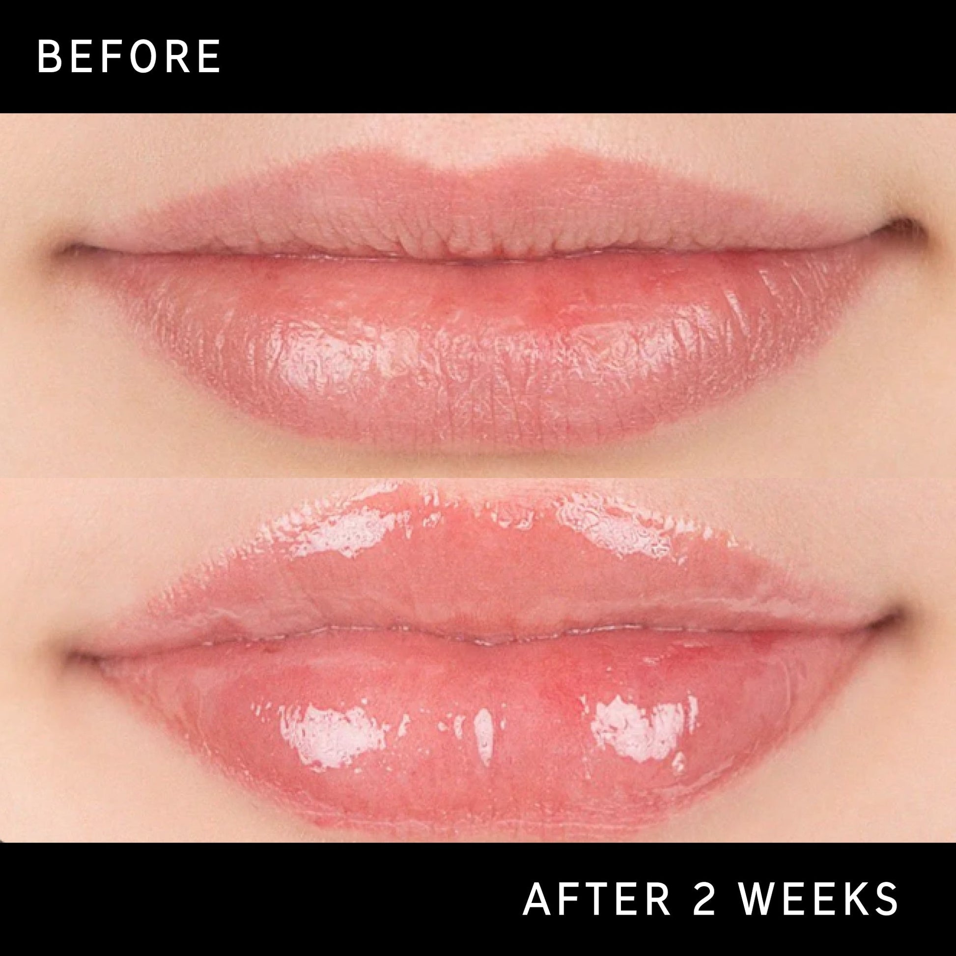 lip-plumping-duo-f5 DTC-Top15_Amends_Tripeptide-Lip_B_A.jpg