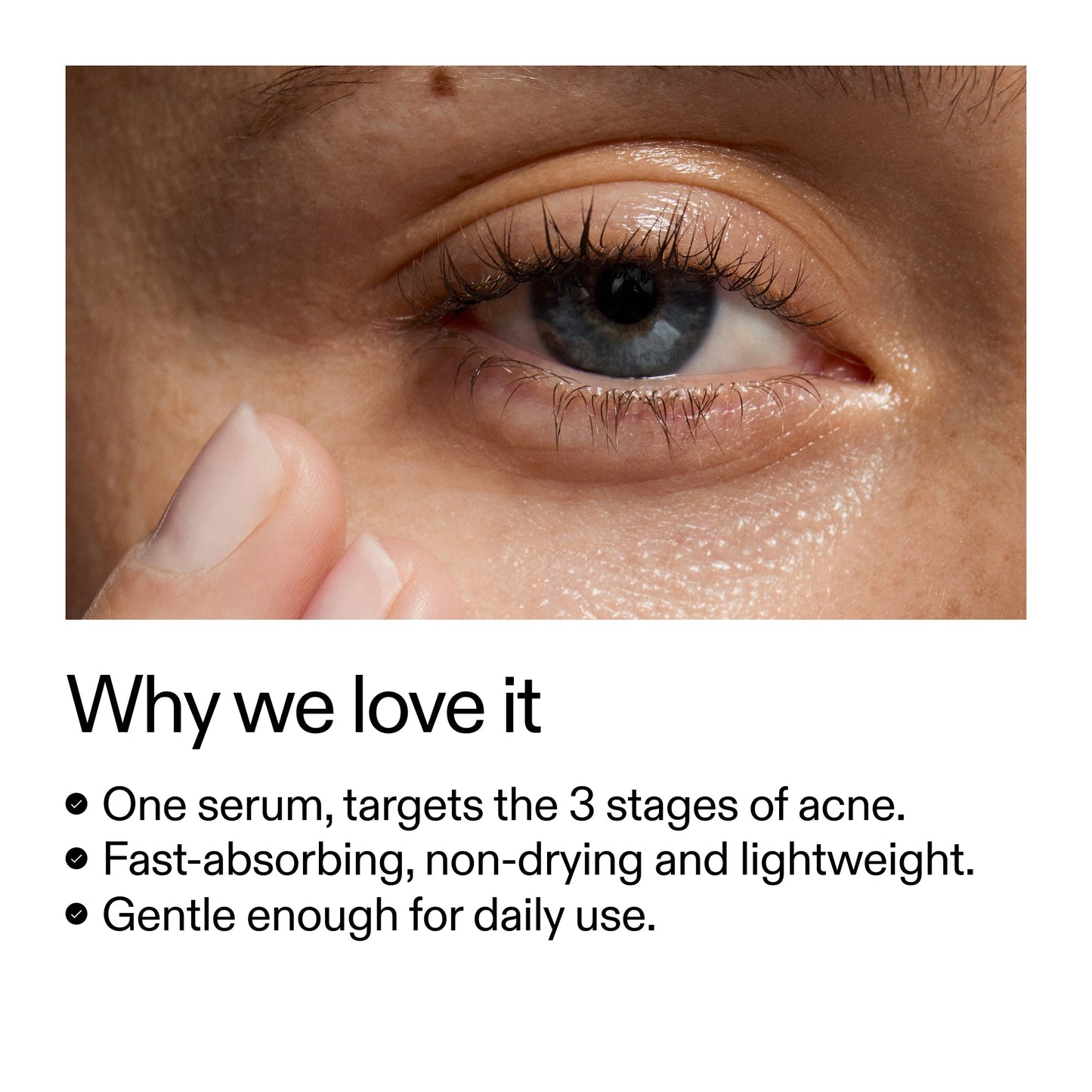 360-acne-clearing-duo-c3 Dioic_Whyweloveit_2000x2000_175aafd3-0cbe-403a-b317-a8362881bfe2.jpg