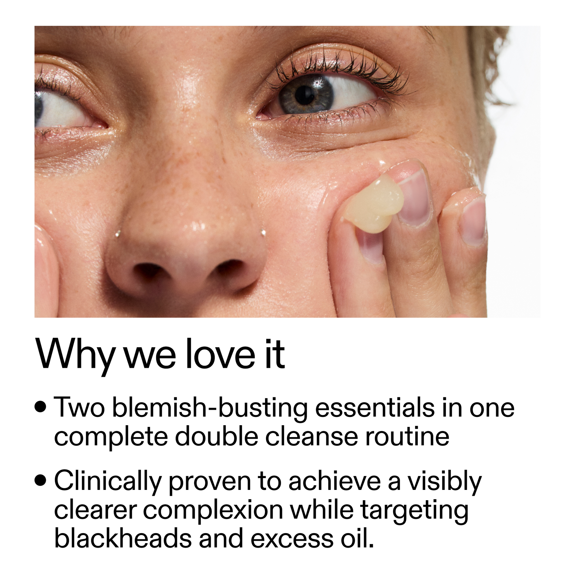acne-double-cleanse-duo-k3 Double_Cleanse_Duo_for_Breakouts_Why_We_2000x2000_f242cb12-bb5c-487c-b203-071ccb406ec5.png