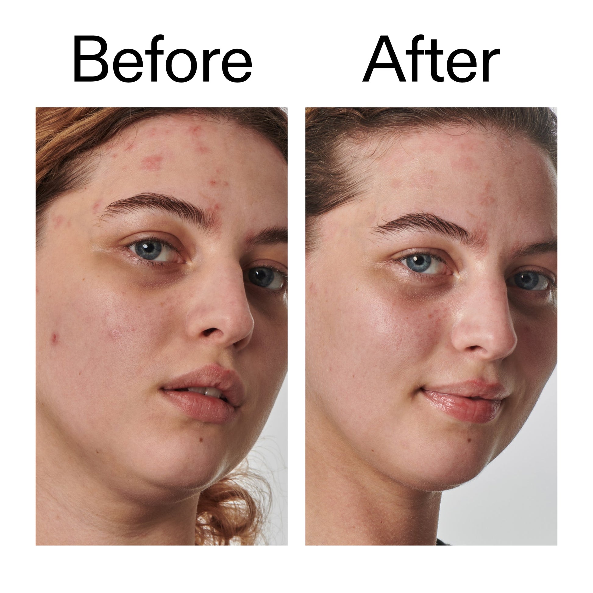 10-urea-moisturizer-c1 Dry_and_Rough_Skin_Solution_Before_After_2000x2000_efa6e639-5c39-49bd-a5dd-f0220293120a.jpg