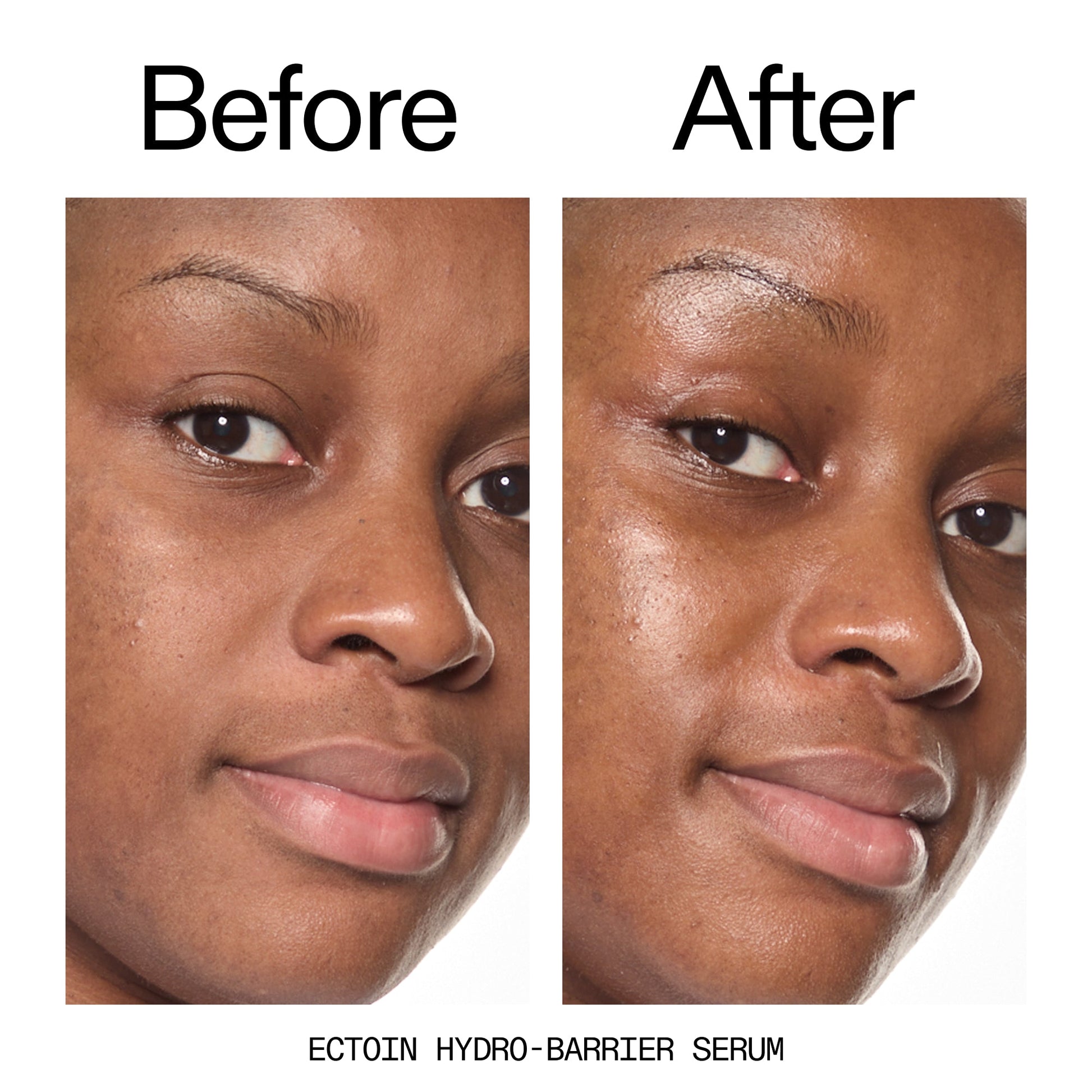 barrier-boosting-trio-r8 Ectoin_Before_After_2000x2000_ce35bc41-4da0-4b6f-adc7-29f8641f6c6c.jpg
