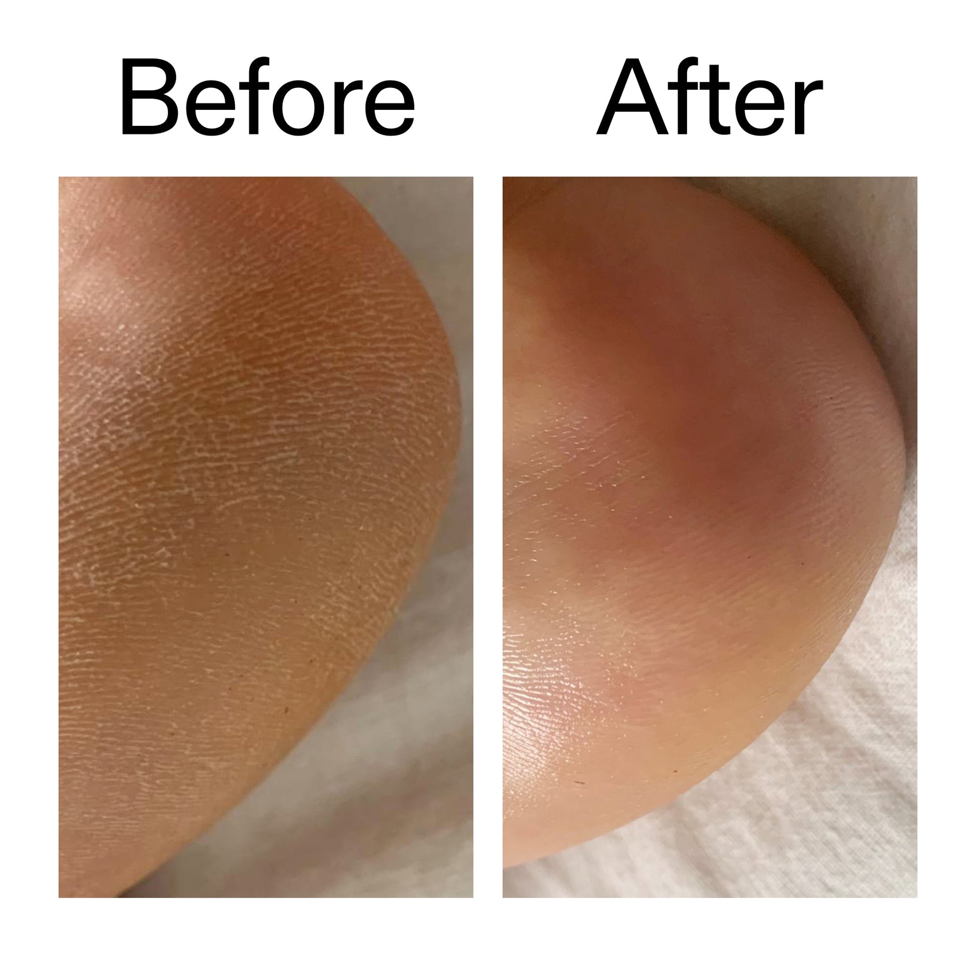 glycolic-acid-exfoliating-body-stick-w7 Glycolic_Acid_Exfoliating_Body_Stick_Before_After_V1_2000x2000_a3043625-9400-429a-a7fb-d6dbd220f722.jpg