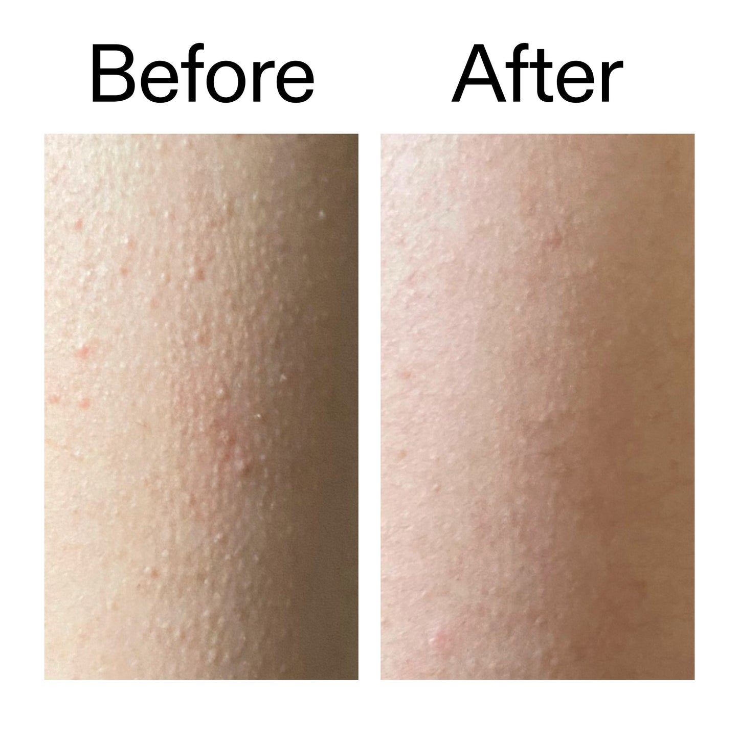 glycolic-acid-exfoliating-body-stick-duo-u2 Glycolic_Acid_Exfoliating_Body_Stick_Before_After_V2_2000x2000_2e4ba052-94f6-4d56-82df-7bdb5b2df7ae.jpg