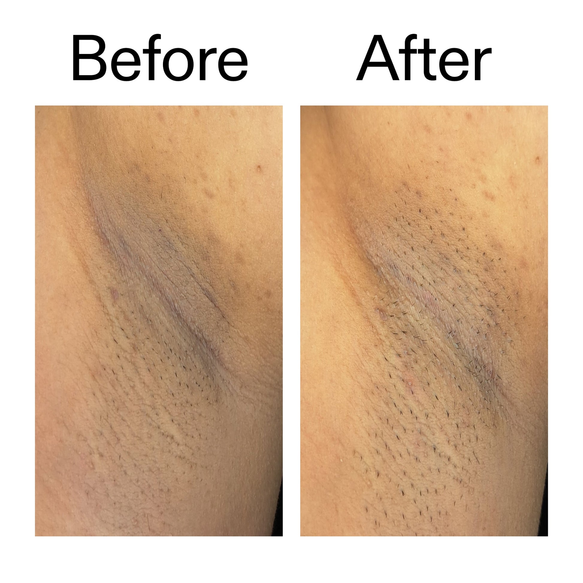 glycolic-acid-exfoliating-body-stick-w7 Glycolic_Acid_Exfoliating_Body_Stick_Before_After_V3_2000x2000_ea919cd9-1439-4a46-82a0-76200eb5bb42.jpg