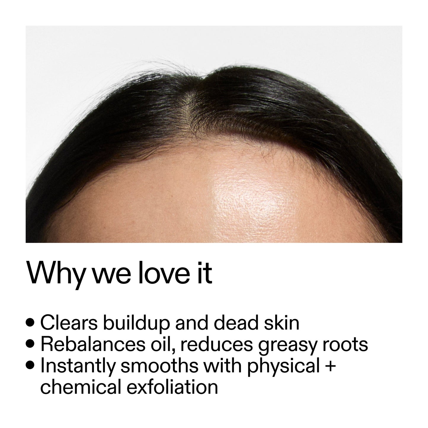 glycolic-acid-exfoliating-scalp-scrub-x8 Glycolic_Acid_Exfoliating_Scalp_Scrub_Why_we_love_it_2000x2000_46f65fb2-7d5a-4610-9788-873f5cb54602.jpg
