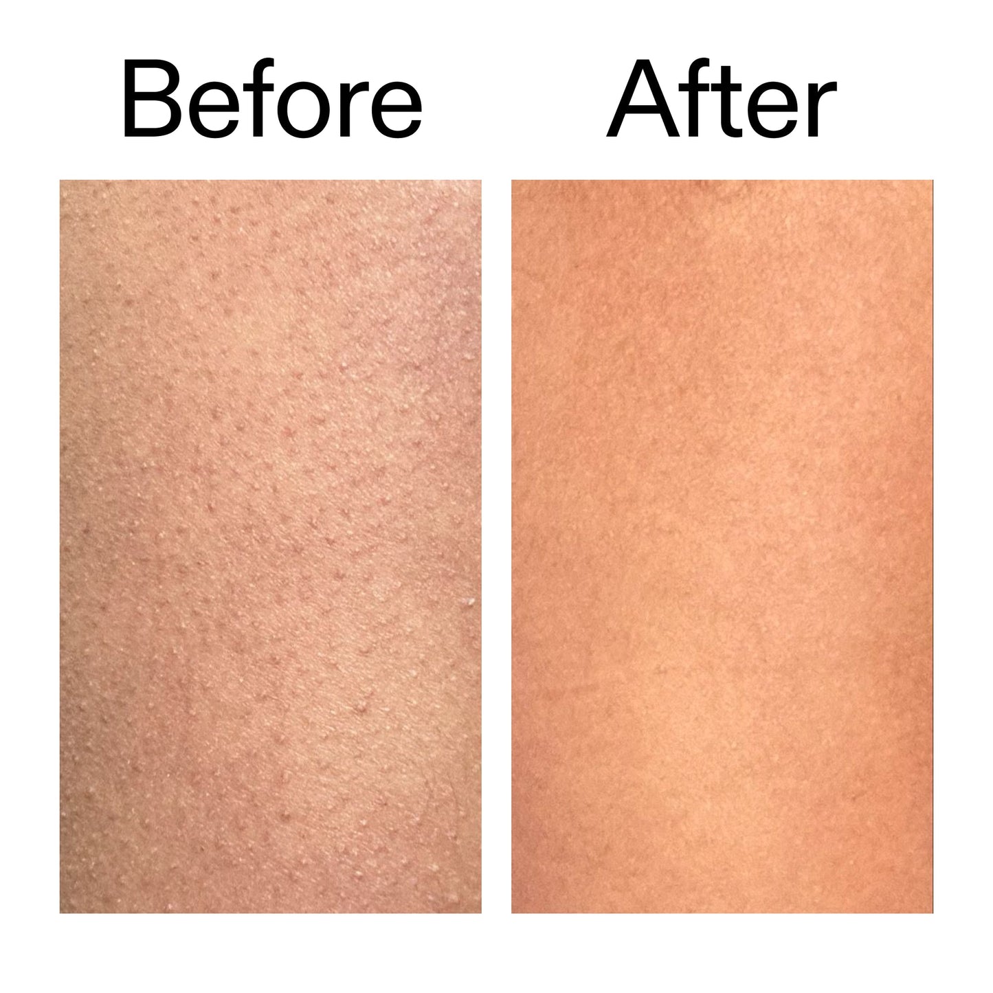 glycolic-acid-exfoliating-body-stick-w7 Glycolic_Body_Stick_B_A_2000x2000_6e6e6b4d-5bd7-43c0-aeed-4d66788e8995.jpg