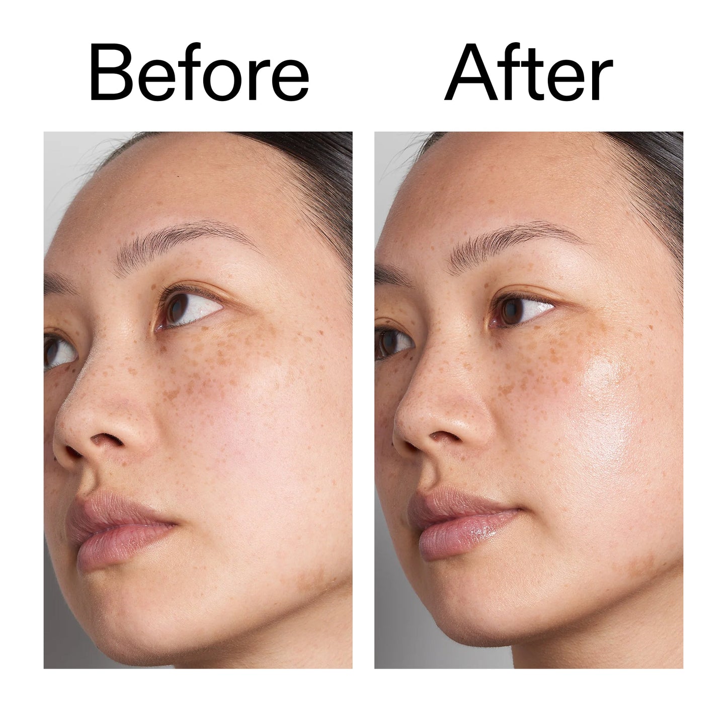 supersize-hyaluronic-acid-serum-100ml-i3 Hyaluronic_Acid_Before_After_2000x2000_d7983956-8aa2-4ea3-8255-c63e8d4f892e.jpg