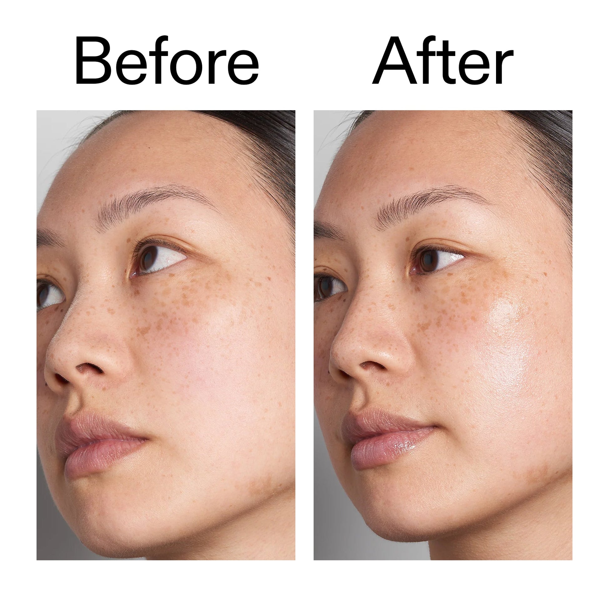supersize-hyaluronic-acid-serum-100ml-duo-g9 Hyaluronic_Acid_Before_After_2000x2000_d7983956-8aa2-4ea3-8255-c63e8d4f892e.jpg