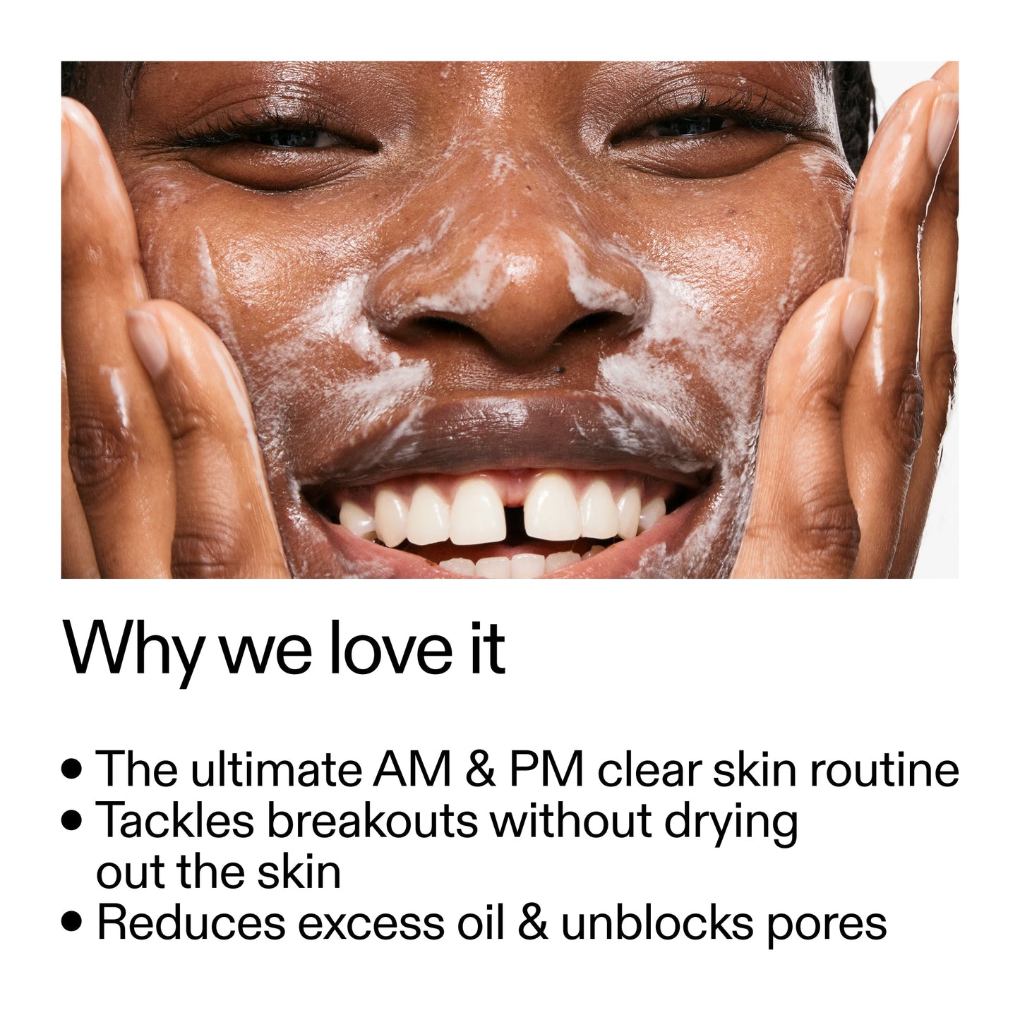intro-routine-for-acne-t4 Intro_Routine_for_Acne_Why_we_love_it_2000x2000_42499e10-4629-4a0e-a627-7e215f4da6bc.jpg