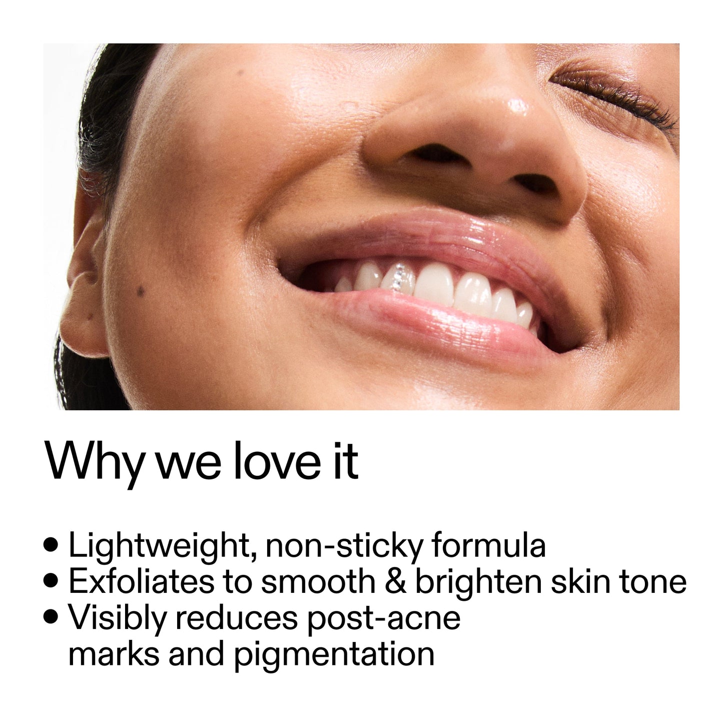 mandelic-acid-treatment-p9 Mandelic_Acid_Treatment_Why_we_love_it_2000x2000_6dfe29a9-2a79-464f-a5e8-e5ac37d93388.jpg