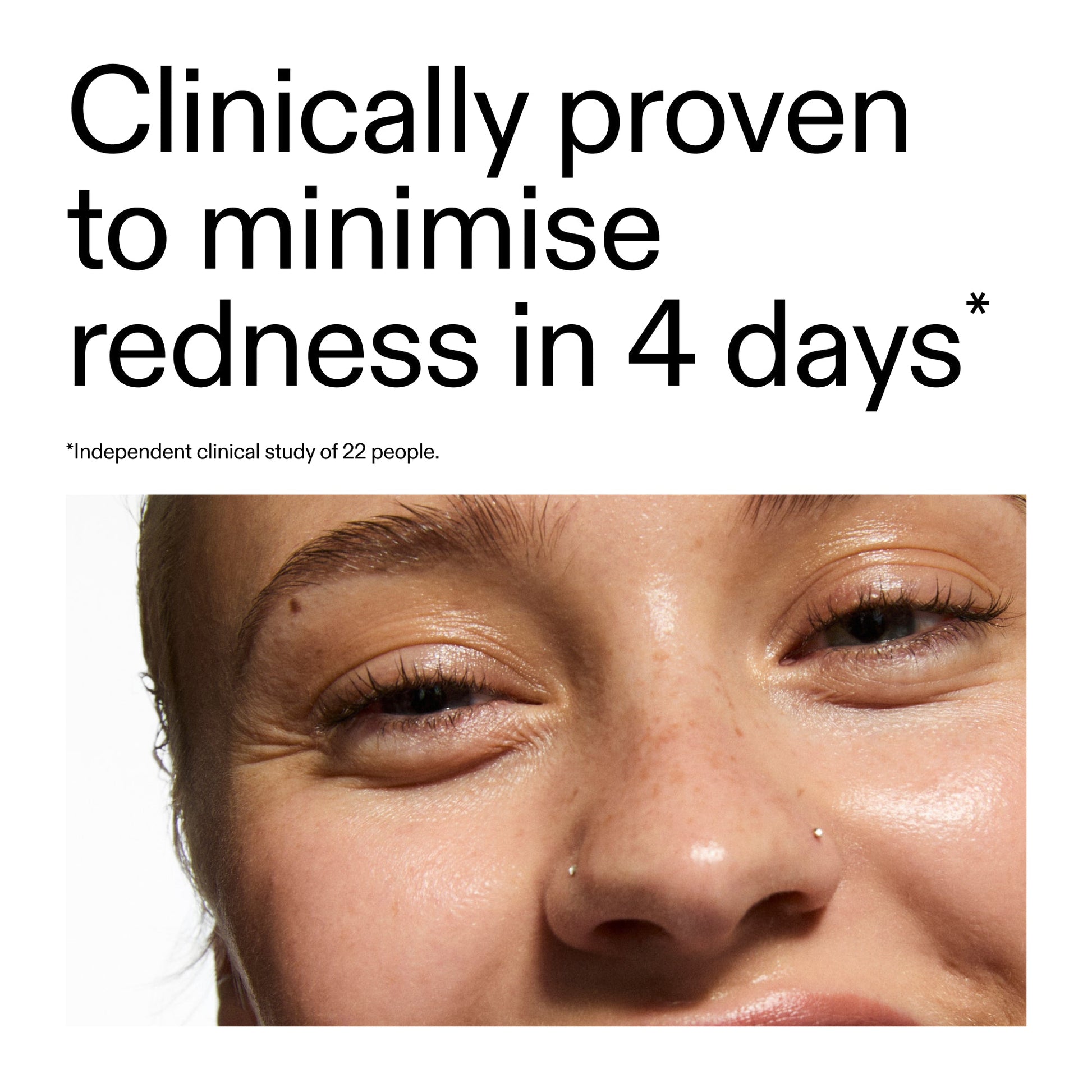 10-azelaic-acid-serum-for-redness-relief-a5 Oat_Cleansing_Balm_Claim_2000x2000_52a841dc-353c-4f2c-8646-3aadb604507d.jpg