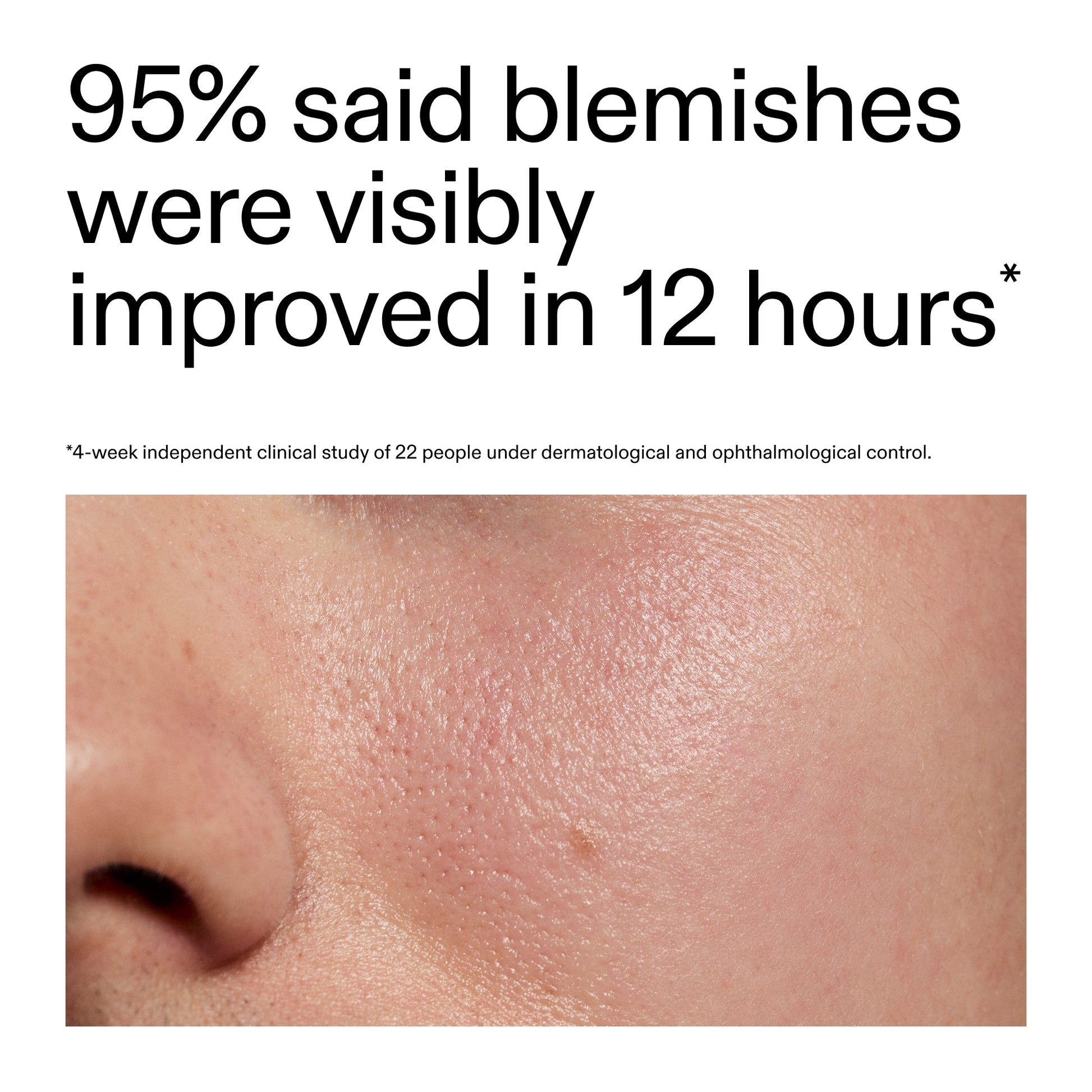 succinic-acid-acne-treatment-a4 Oat_Cleansing_Balm_Claim_2000x2000_ac6ce553-25db-41b2-a981-faae1ac4b8c0.jpg
