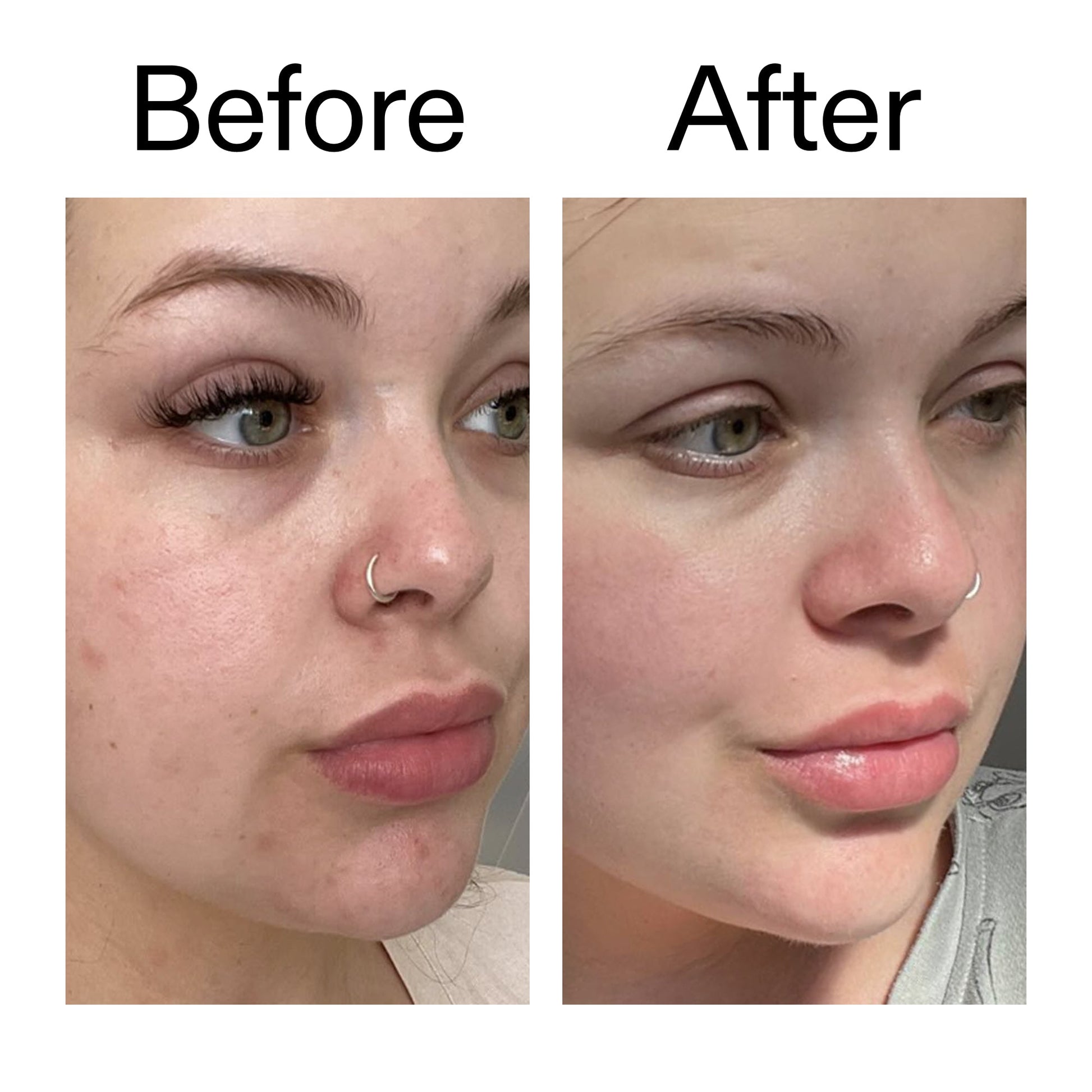 supersize-omega-water-cream-100ml-c8 Omega50_Before_After_2000x2000_46483ed8-3f9d-487f-9a0c-9df79830bd65.jpg