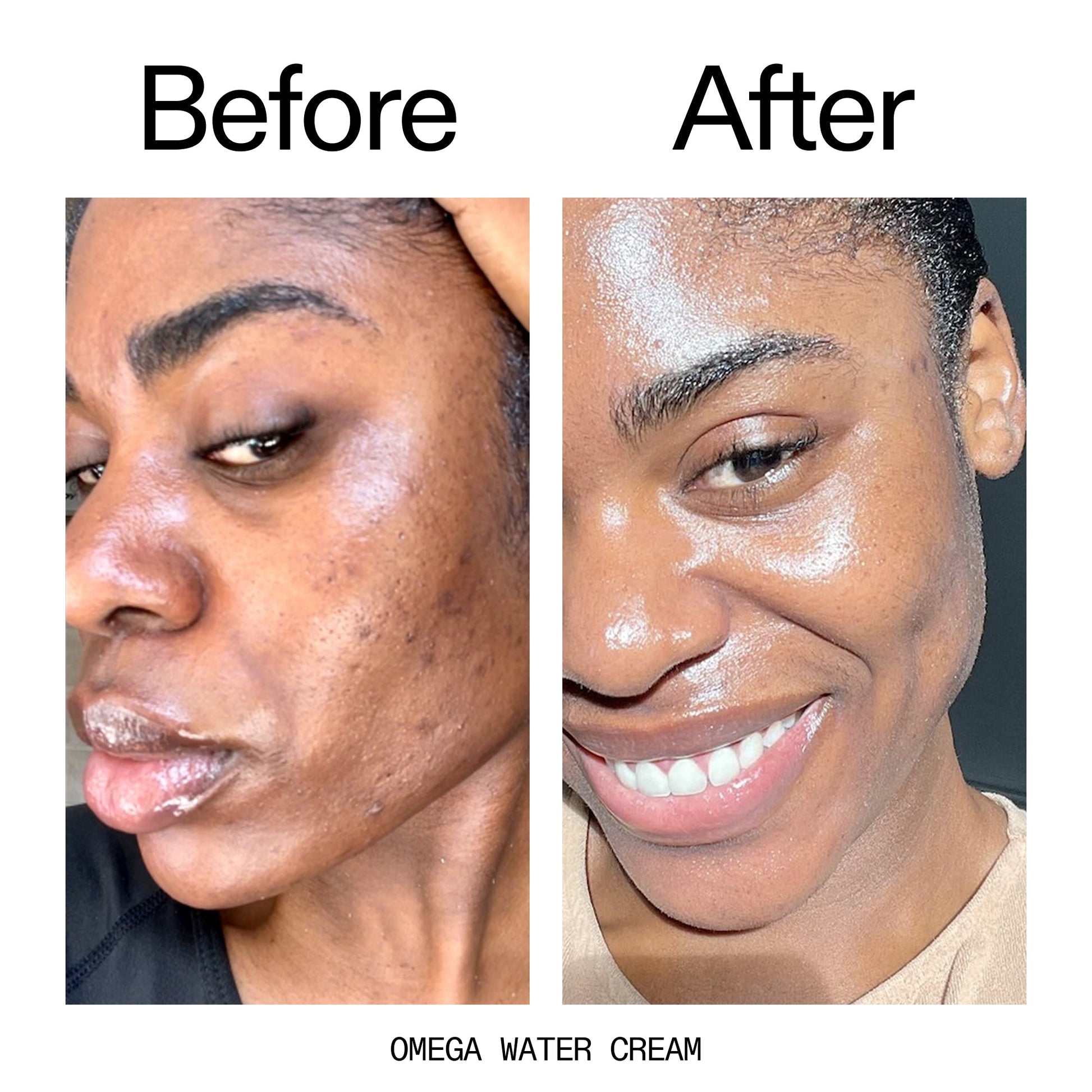 glowing-skin-set-x9 Omega_Water_Cream_Before_After_2000x2000_8e88278b-8c8d-48dc-ac77-4e98ebbd1b77.jpg