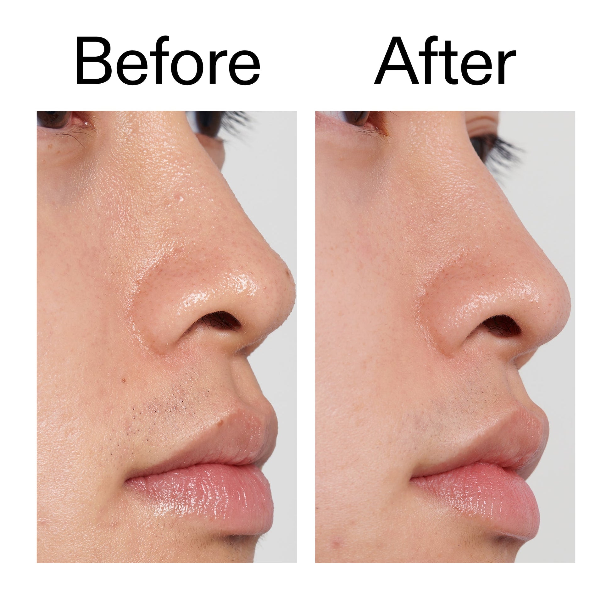 pha-toner-d5 PHA_Toner_Before_After_2000x2000_e3c10172-0150-4342-8b95-57417eaff50d.jpg