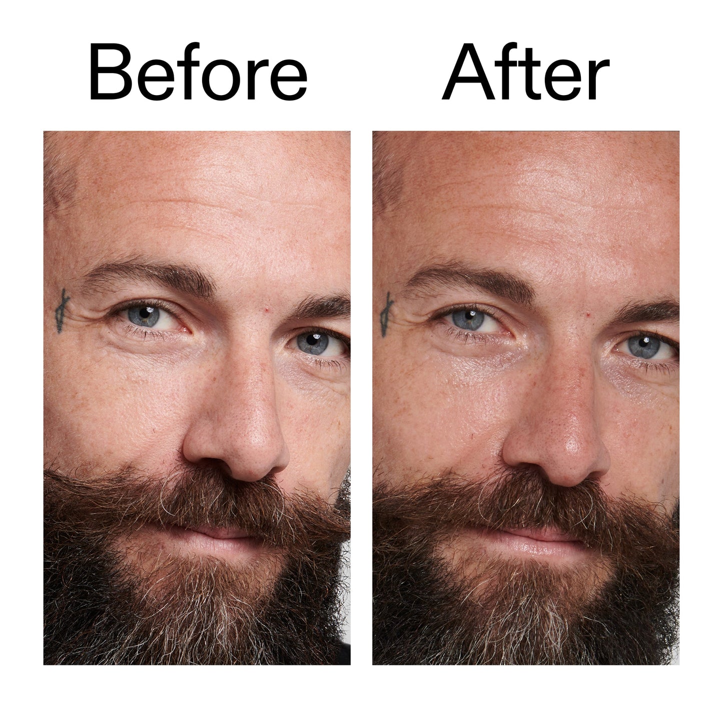 peptide-moisturizer-a0 Peptide_Moisturizer_Before_After_2000x2000_84623fe4-7b72-4f89-8e87-5edb6c752ac5.jpg