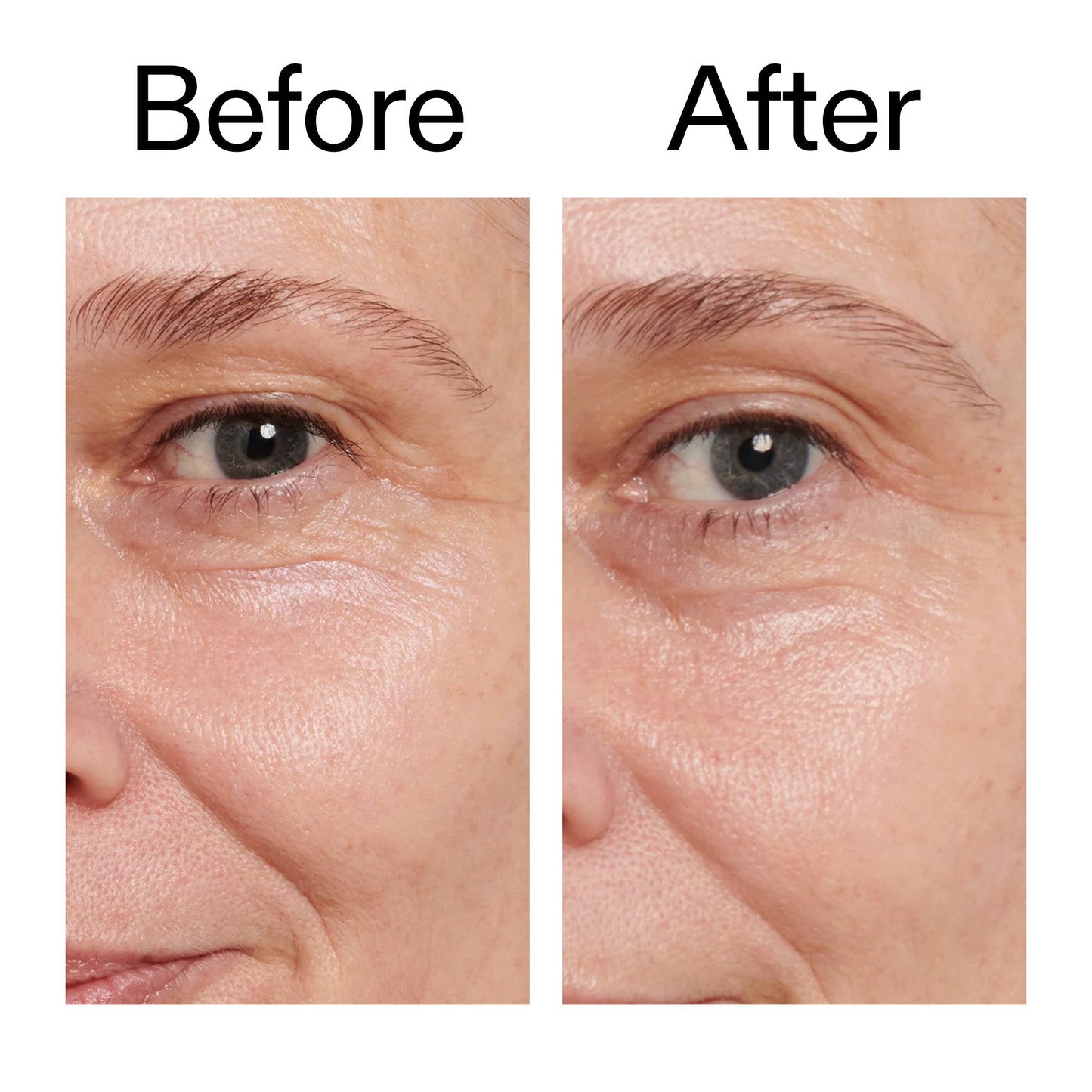retinol-eye-cream-h4 Retinol_Eye_Cream_Before_After_2000x2000_ac03a80c-109e-4572-a95a-91dc109b4d27.jpg
