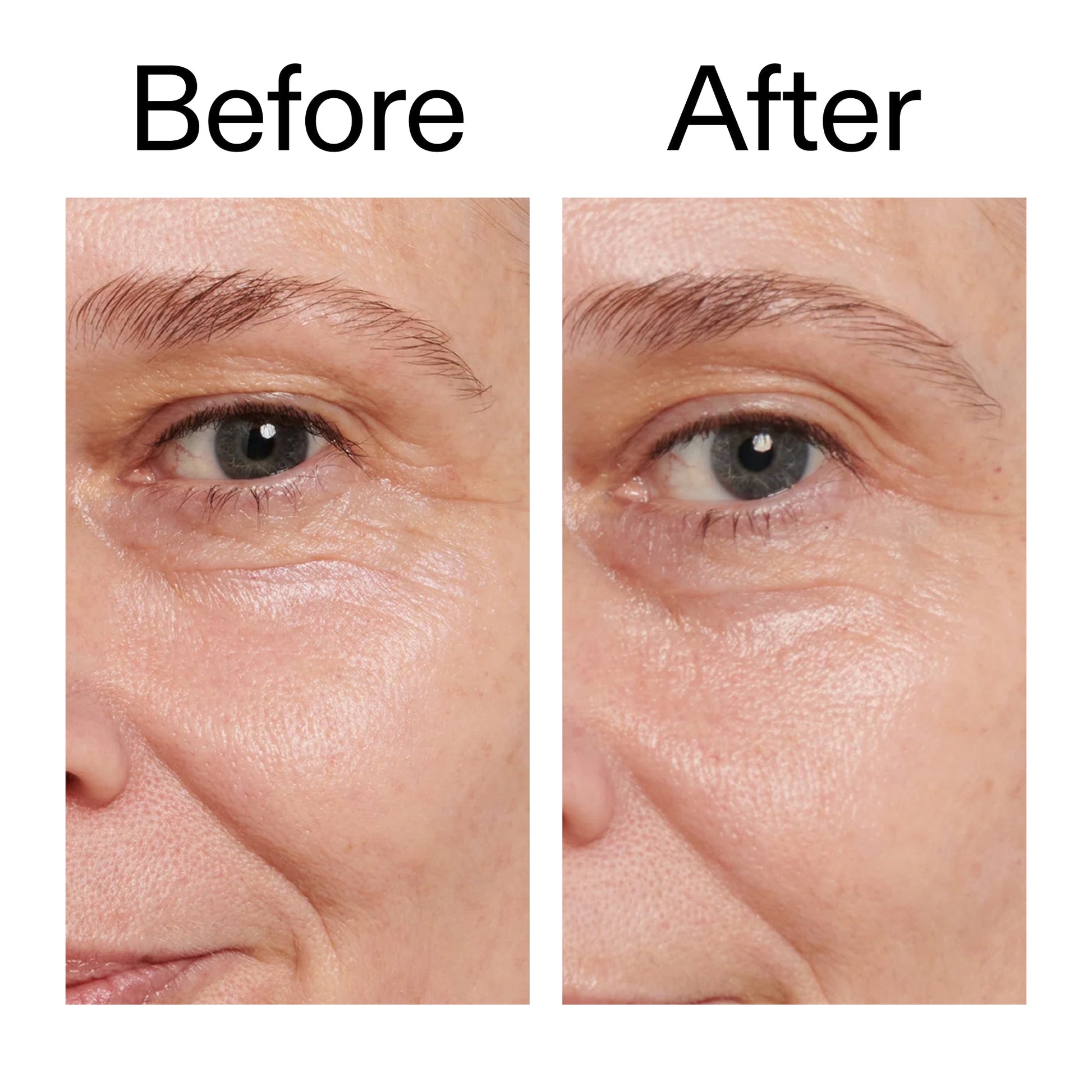 retinol-eye-cream-h4 Retinol_Eye_Cream_Before_After_2000x2000_ac03a80c-109e-4572-a95a-91dc109b4d27.jpg