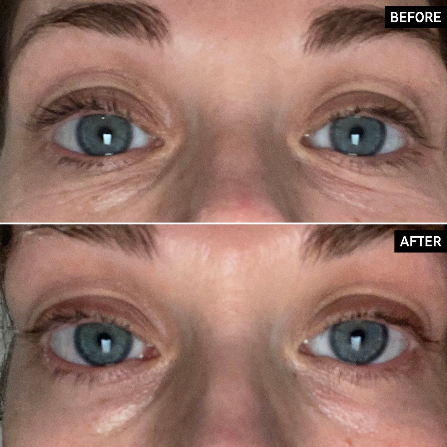 retinol-eye-cream-h4 SITE-UGCBAsApril_Nicole_B_A_PPage_2000x2000_1.jpg