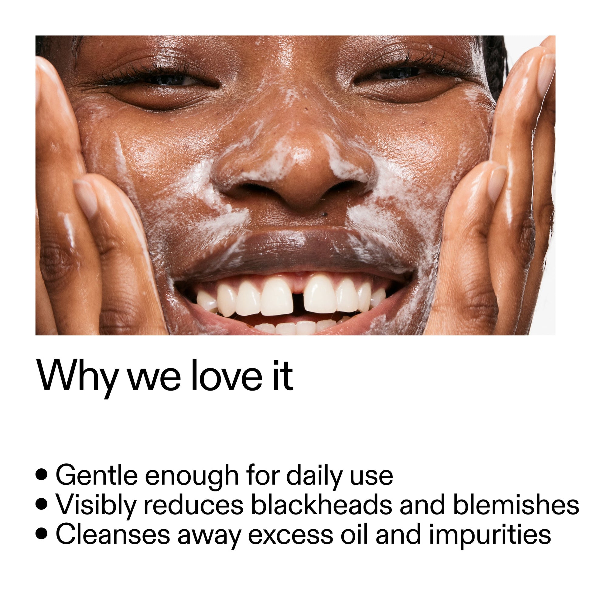 salicylic-acid-cleanser-150ml-c3 Salicylic_Acid_Cleanser_-_300mlWhy_we_love_it_2000x2000_87dc92a9-2559-4309-98cd-4e570f1be735.jpg