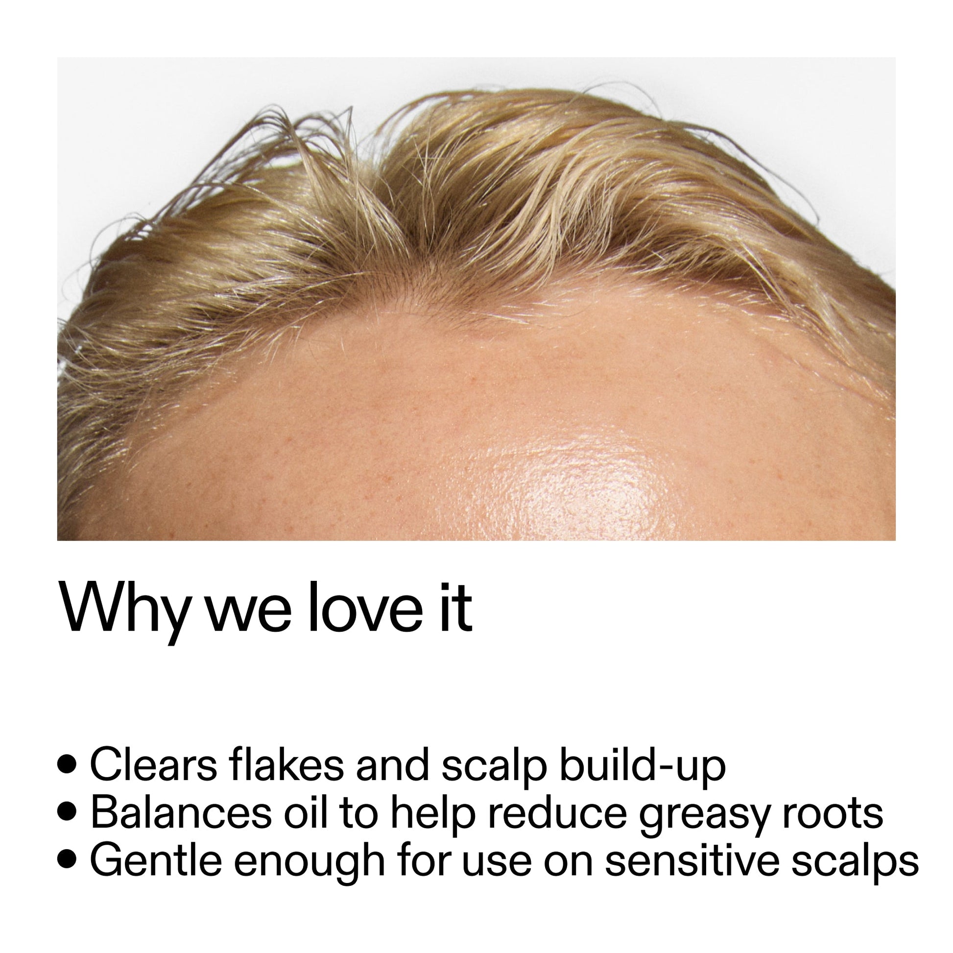 salicylic-acid-exfoliating-scalp-treatment-n5 Salicylic_Acid_Exfoliating_Scalp_Treatment_Why_we_love_it_2000x2000_44b6bd6d-9ec4-4b23-9dc4-bc3fd6f28e14.jpg