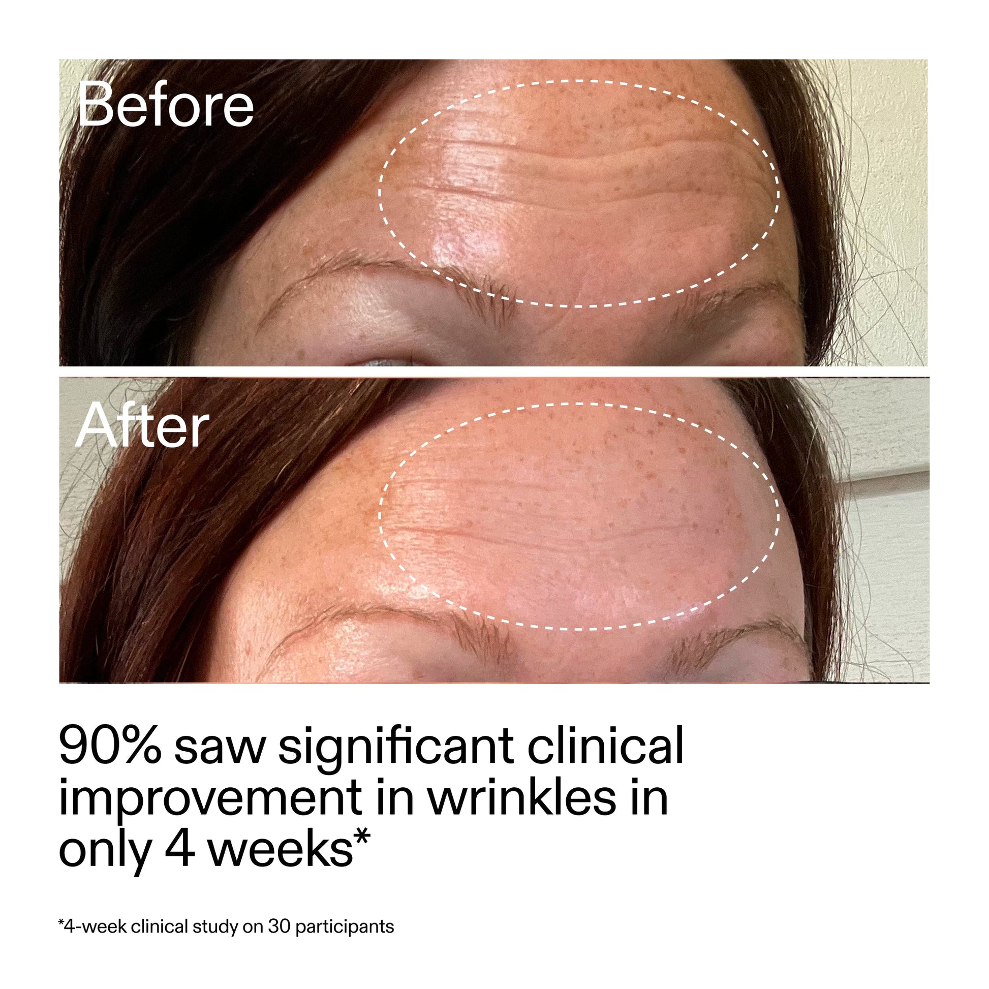 starter-retinol-serum-q5 StarterRetinol_BeforeAfter_Claim1_2000x2000_a09b50b6-4688-4527-abae-21bd142b89b7.jpg