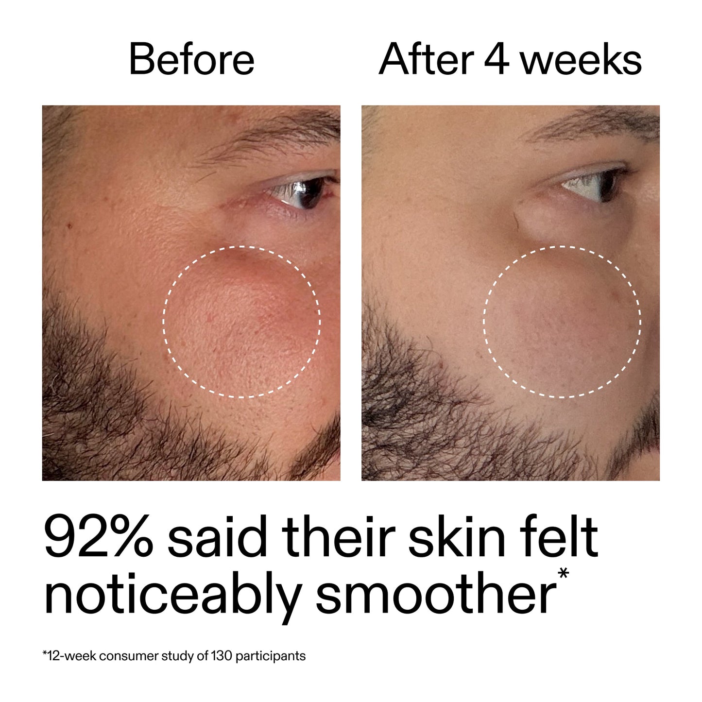 starter-retinol-serum-q5 StarterRetinol_BeforeAfter_Claim3_2000x2000_6ceab106-e0ee-4ed4-ba62-41bc39538038.jpg