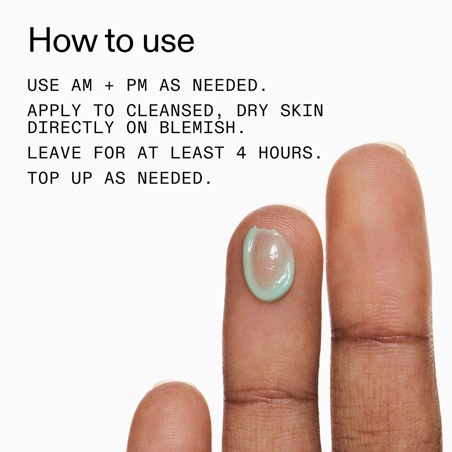 succinic-acid-acne-treatment-a4 Succinic_Acid_Treatment_How_to_Use_2000x2000_d57137d5-d7f1-427c-9a46-5fc00c19c542.jpg