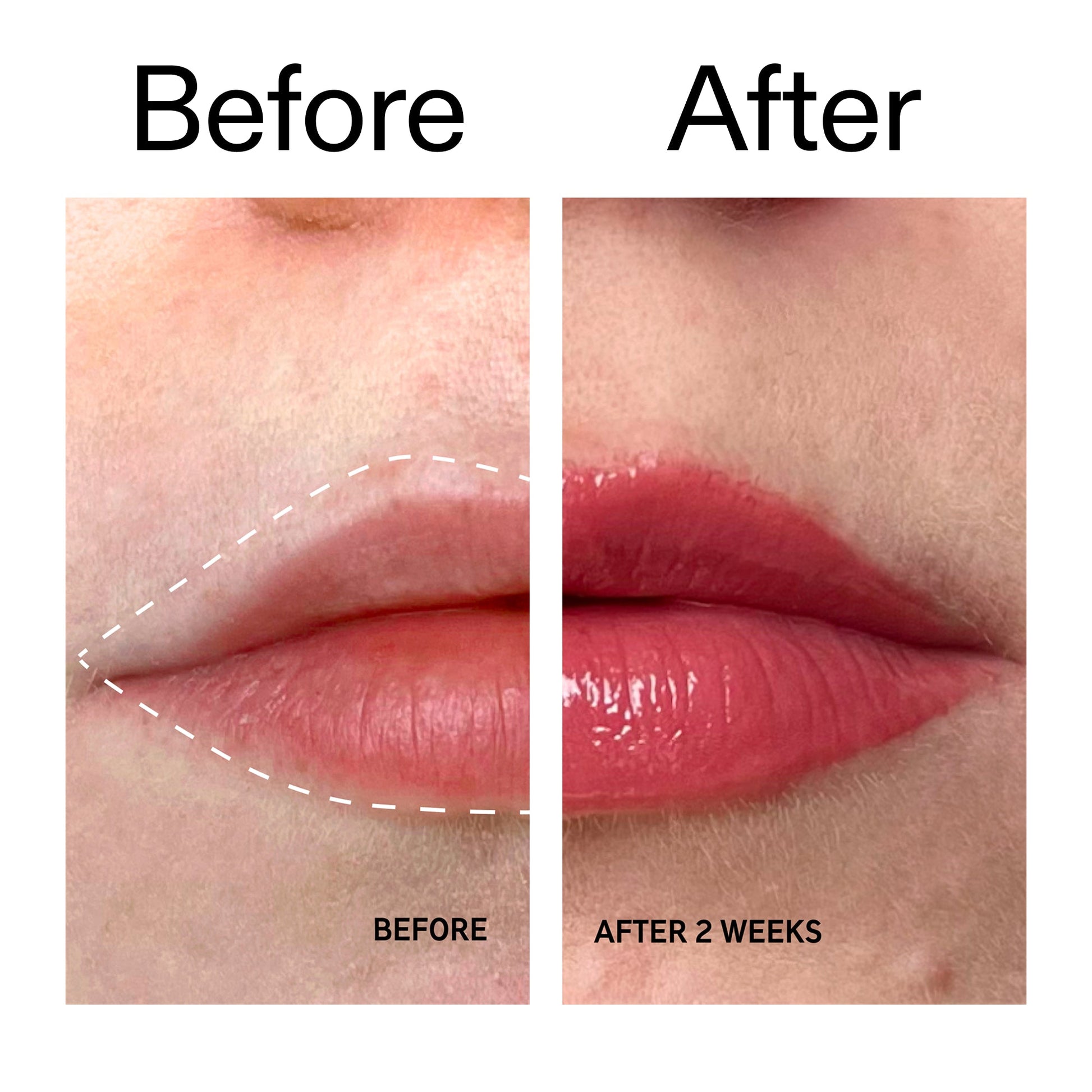tripeptide-plumping-berry-lip-balm-a3 Tripeptide_Plumping_Lip_Balm_-_Berry_Before_After_2000x2000_9474bbd8-43ca-4b0e-b0e7-dfab70b91927.jpg