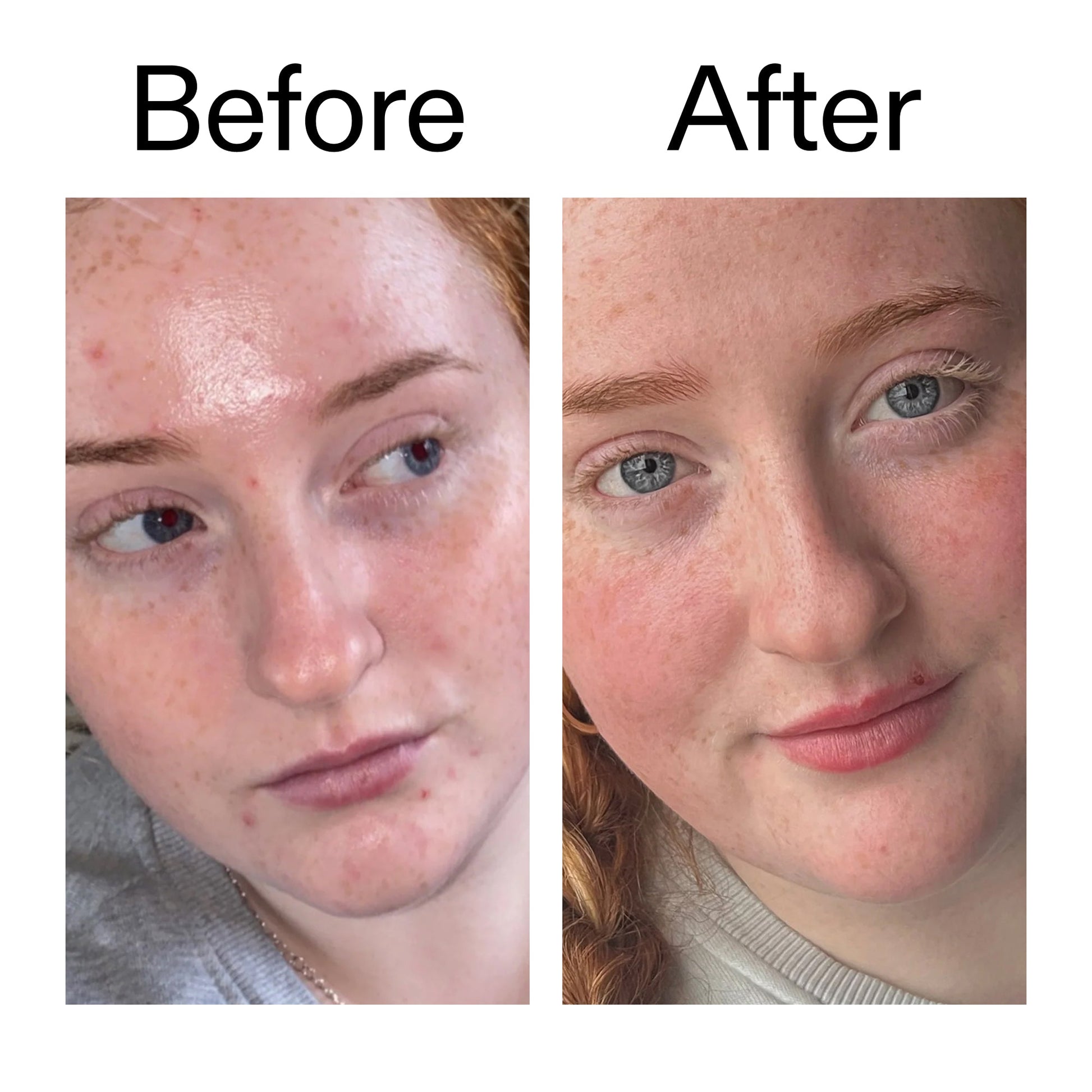 vitamin-b-c-and-e-moisturizer-r3 Vitamin_B_C_and_E_Moisturizer_Before_After_2000x2000_b0781a76-5ad2-4be9-95b8-ef92b356833c.jpg