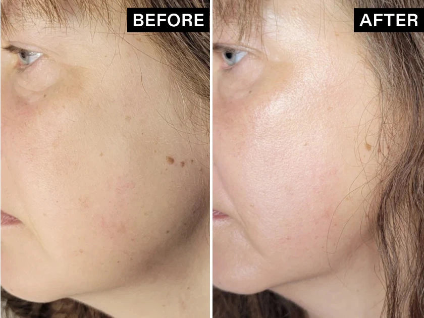 Before and after skin results